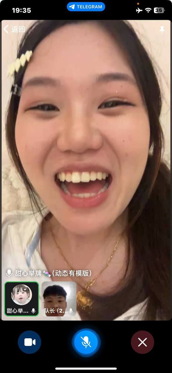 痔疮是什么东西

88 / 作者:季伯长 / 