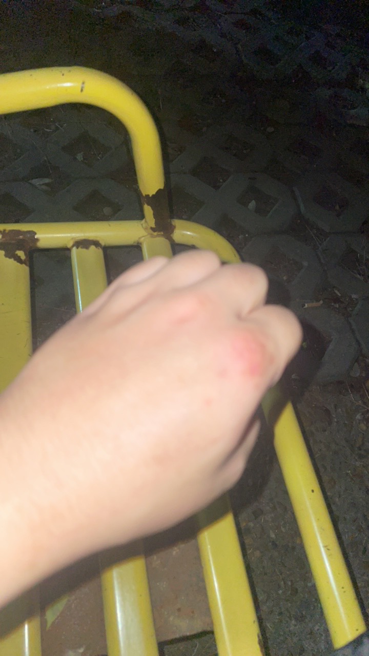 这么冷的天，还有蚊子 ？我真的服 又咬了几个包

33 / 作者:寻梦青年2 / 