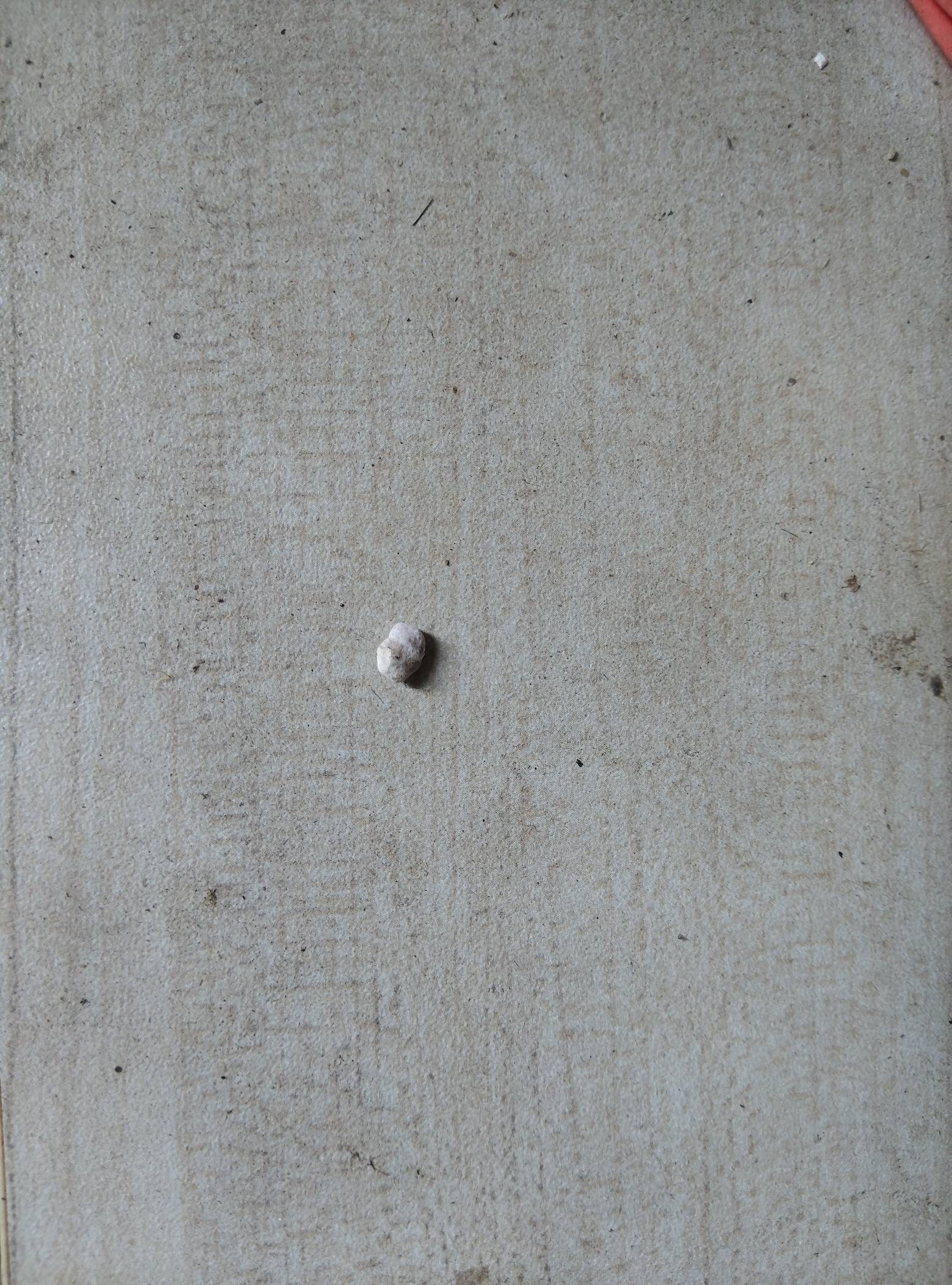 老哥们肾结石真难受阿，这个月排了3颗结石了还有几颗在肾里

96 / 作者:常山阴 / 