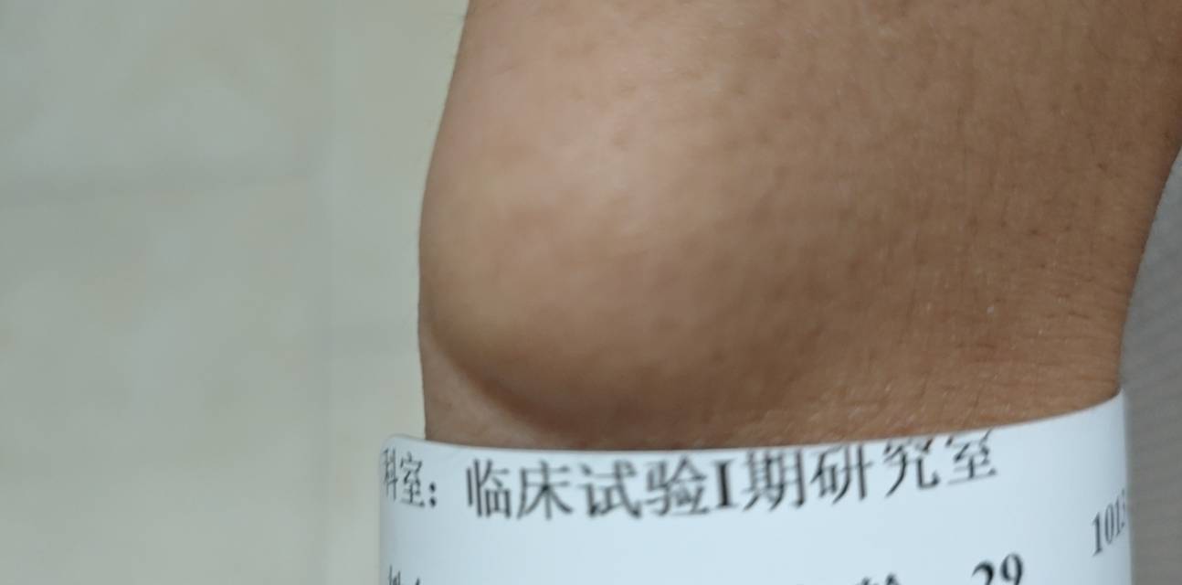 大晚上的打扰大家了，发个帖子说一下，我目前在南宁市某医院一期临床做受试者，做完补73 / 作者:林子韩 / 