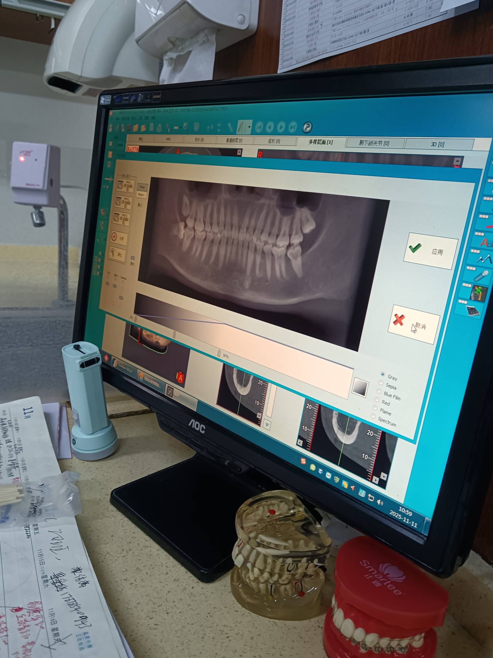 来拔牙了

5 / 作者:挂壁老哥饿了mm / 