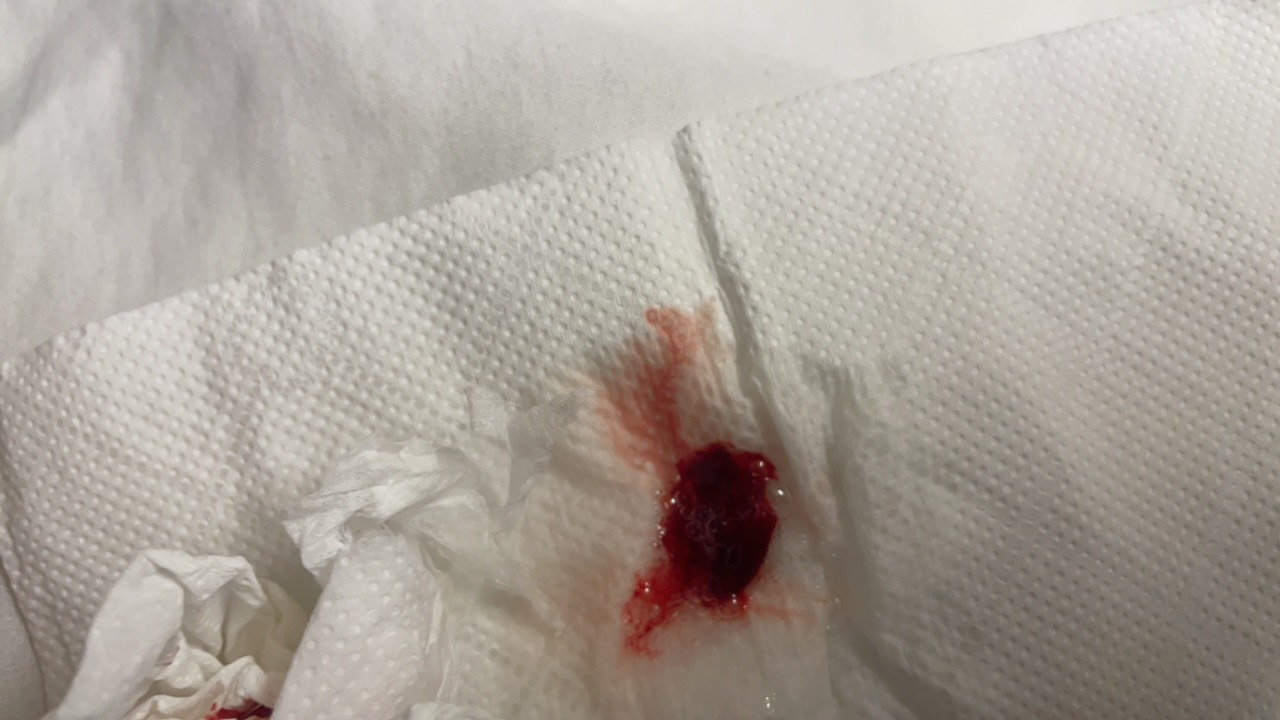 还能活多久

76 / 作者:溜达发财 / 