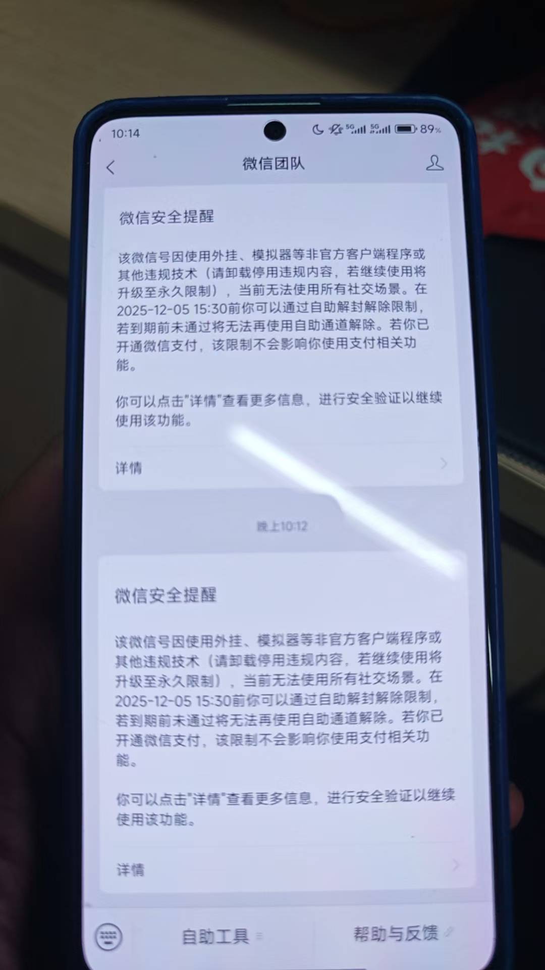 这是咋回事，突然异常了，半个月自动解还是？

48 / 作者:黑狗～ / 