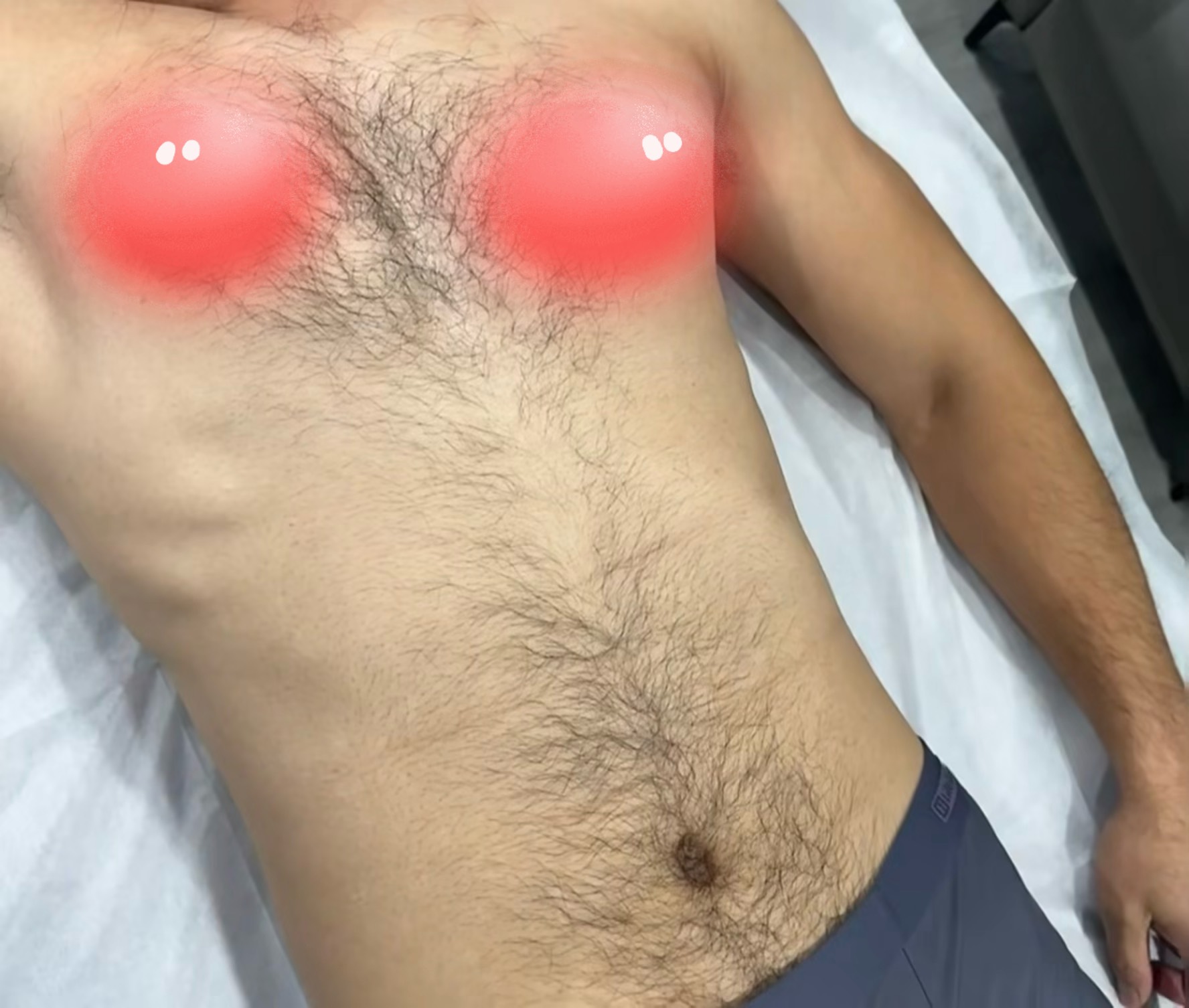 老哥们有激光脱毛过吗
想去激光
这种要多少k能搞定？

20 / 作者:我这辈子废了 / 