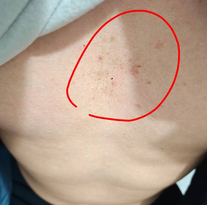 出事了老哥们，这是啥啊，怎么这样，是皮肤病还是绝症老哥们难道我要倒计时挂壁了吗，20 / 作者:YukiXX / 