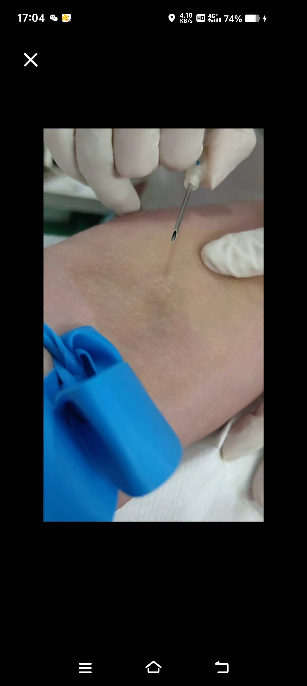 第一次献那玩意，有什么感觉的？针头真的有这么大吗？

35 / 作者:牛魔棒 / 