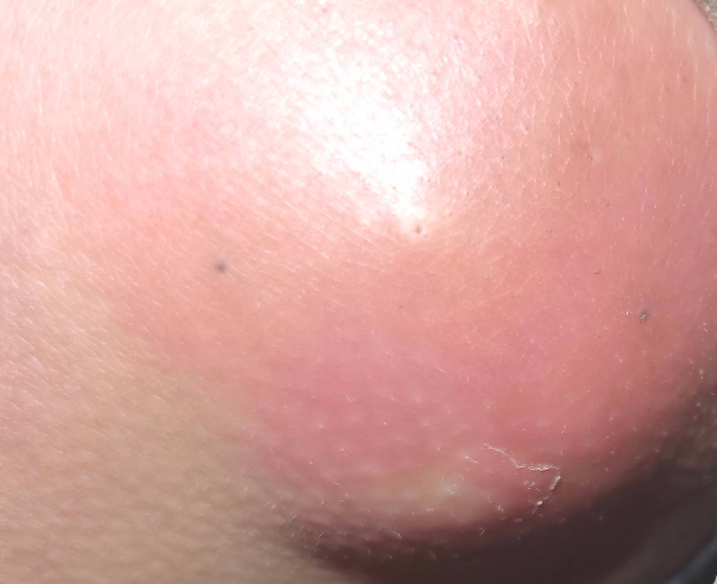 疼死我了

60 / 作者:季伯长 / 