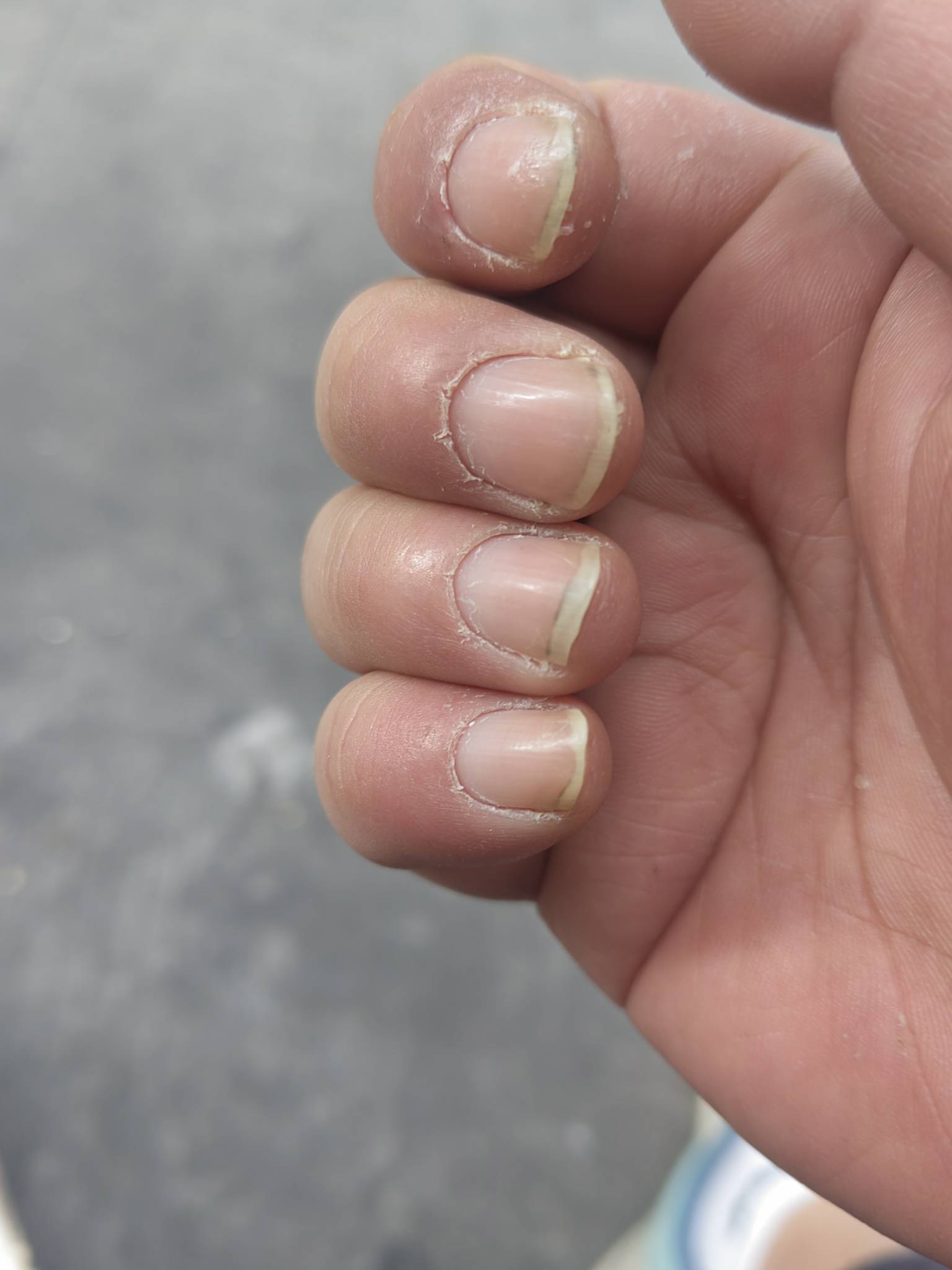 老哥们拼多多物流头程。挑战第九天失败了全是大炮。都不让休息手都干肿了还给我急转夜99 / 作者:miaiai / 