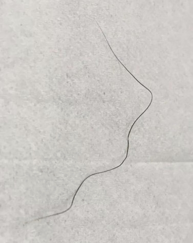 没毛啊发毛啊
26 / 作者:应无所住 / 