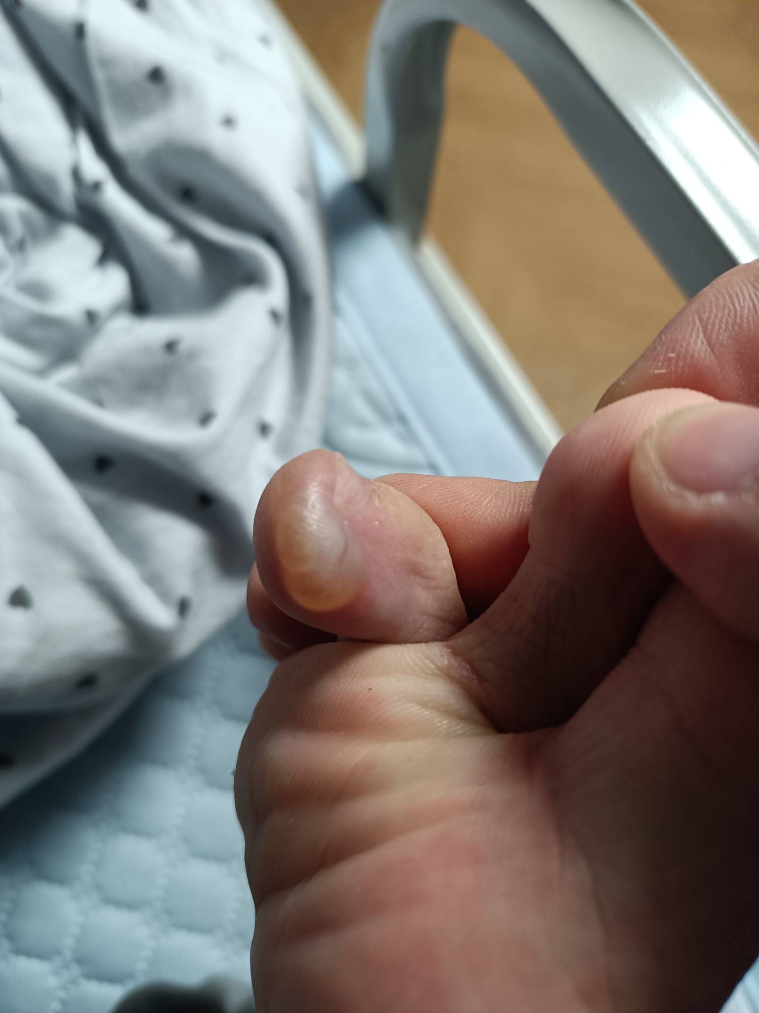 老哥们，命苦啊，干服装仓库拣货，今天走路干出这么大个水泡

82 / 作者:东八区大佬 / 