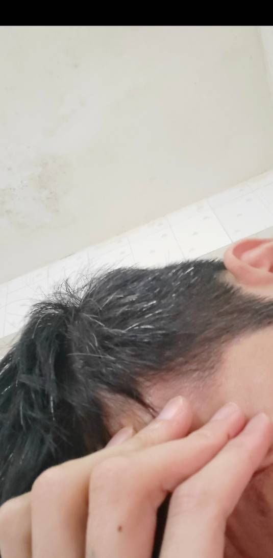 老哥们救我，我头发白完了，该怎么办，我才27岁

22 / 作者:澳村还我奔驰E / 