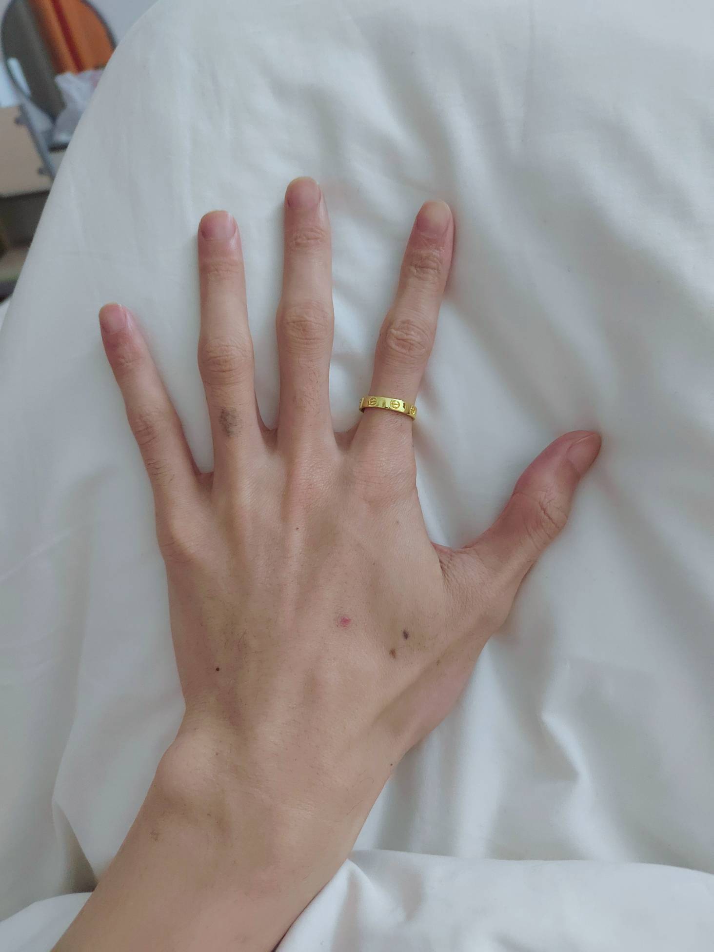 老哥们，我手臂真的太瘦了，刚才被个女的说我是细狗，咋能变胖变壮阿？

55 / 作者:澳村还我奔驰E / 