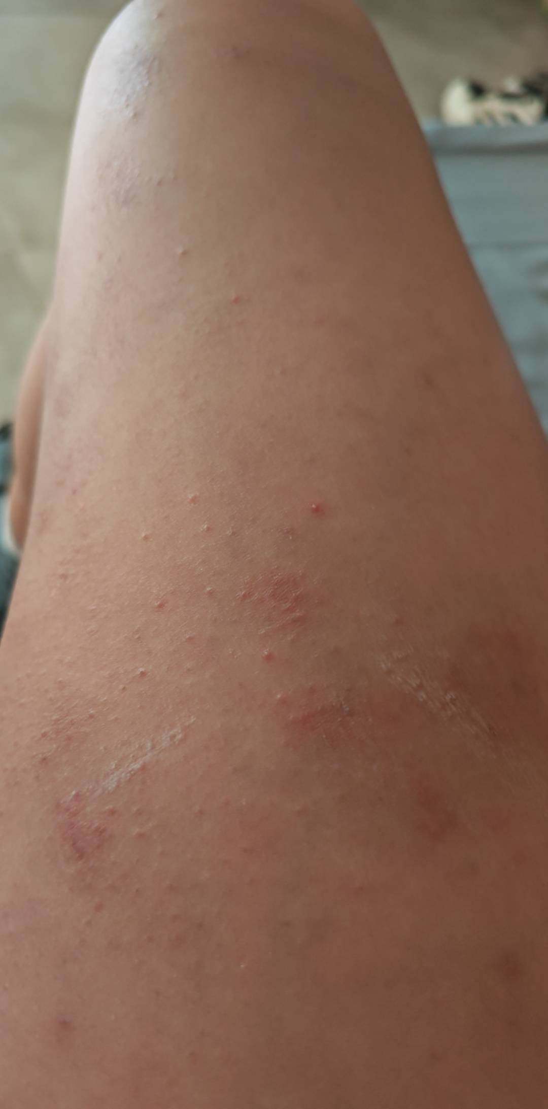 有救吗？？？


68 / 作者:走心亿点点 / 