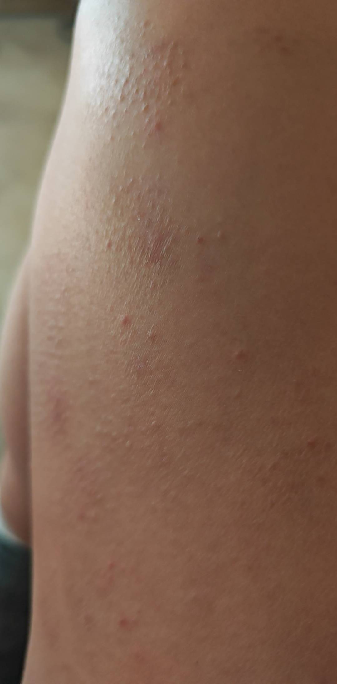 有救吗？？？


41 / 作者:走心亿点点 / 