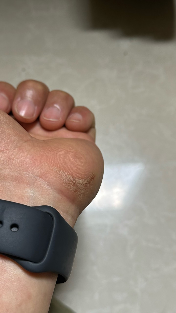 拼夕夕真离谱，50块的买的这么大，练一天休息了5天才恢复过来，手都伸不直

42 / 作者:不知明的靓仔 / 