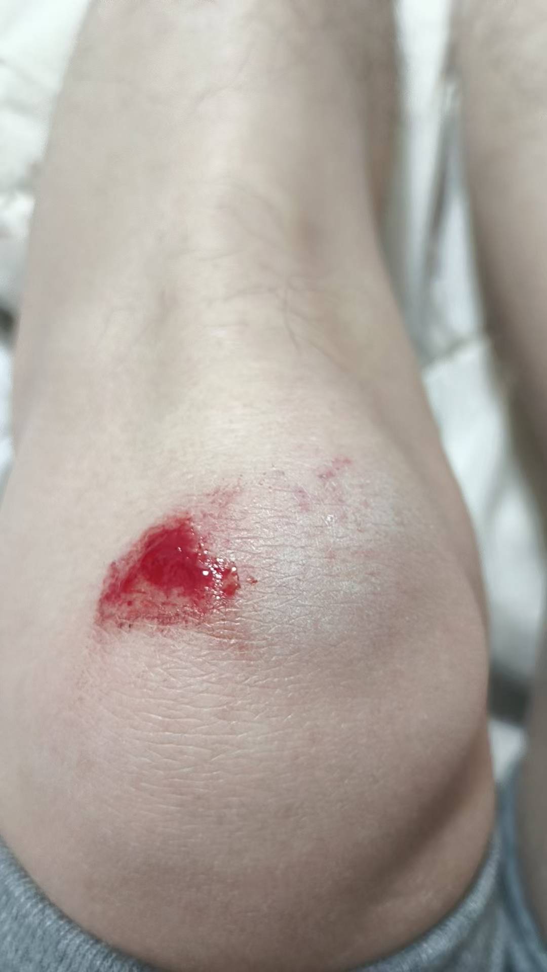 活着真特码难出门跑过外卖赚个百来块也能摔一跤，忍剧痛爬起来回家



85 / 作者:无限星空 / 