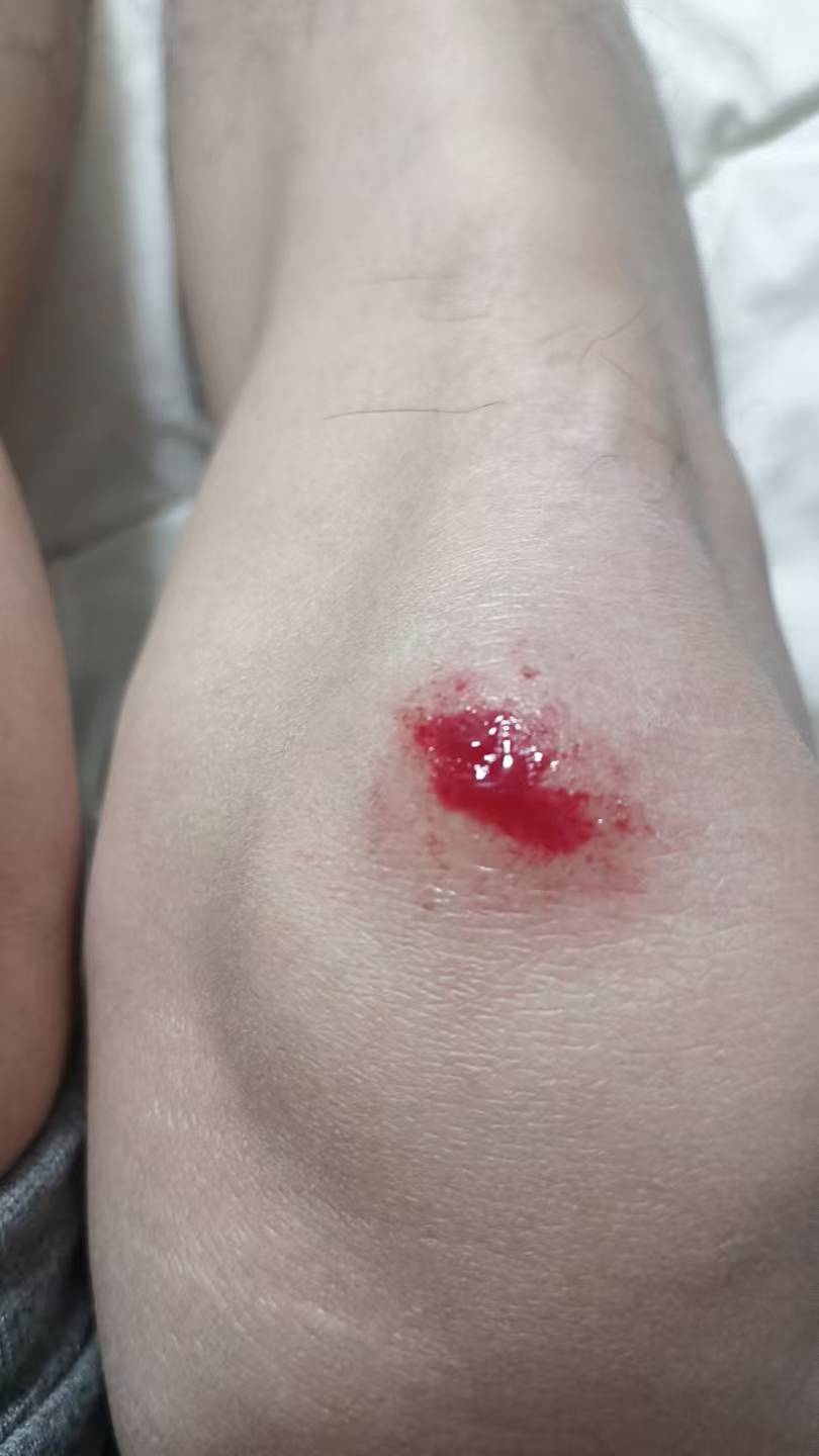 活着真特码难出门跑过外卖赚个百来块也能摔一跤，忍剧痛爬起来回家



26 / 作者:无限星空 / 