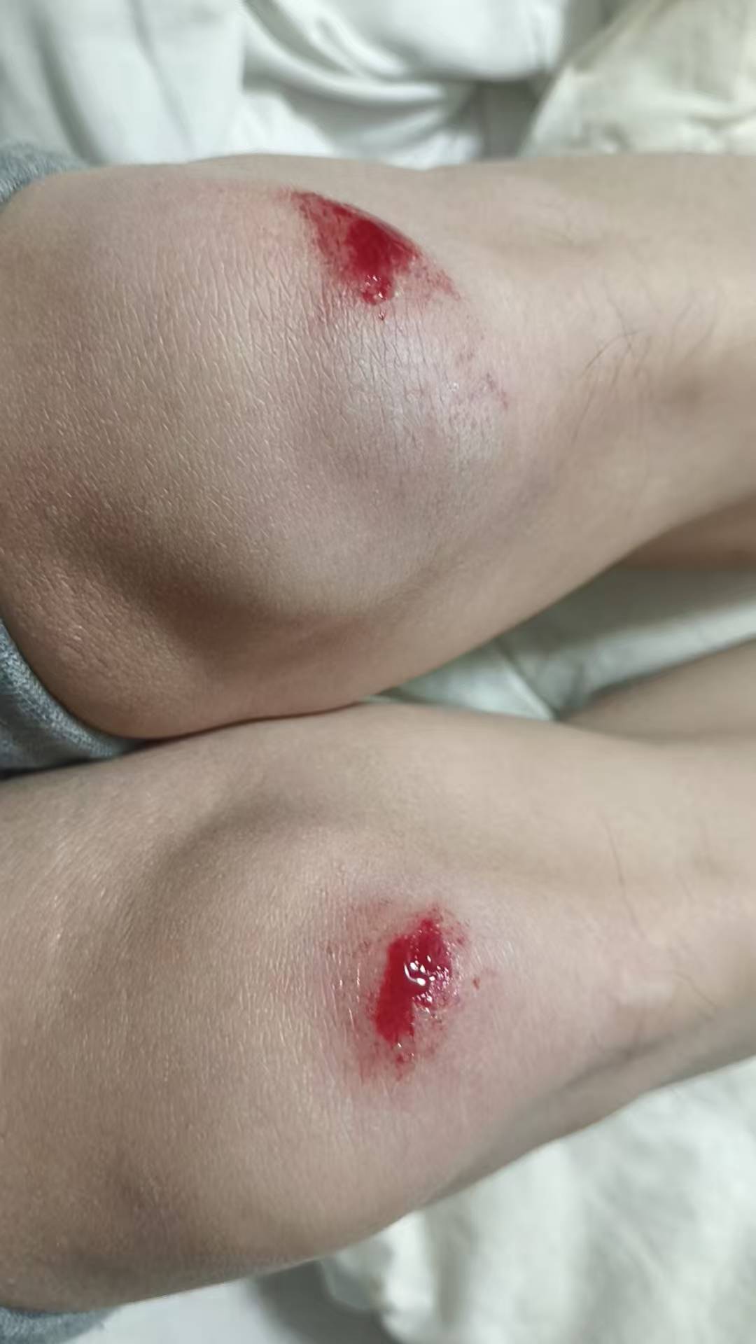 活着真特码难出门跑过外卖赚个百来块也能摔一跤，忍剧痛爬起来回家



20 / 作者:无限星空 / 