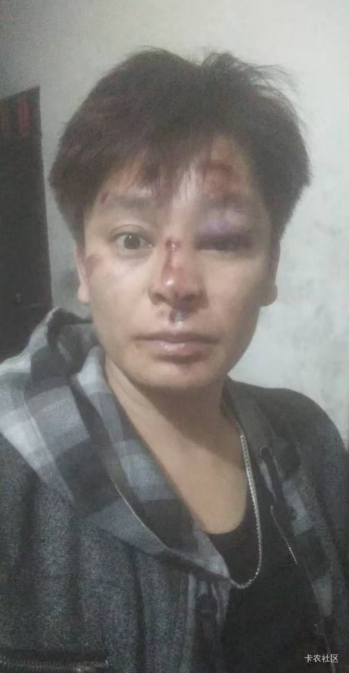 平安一月份申请过的估计都是骗正信，根本就是直接不审核，等夺命贷电话吧

84 / 作者:菇娘芝芝 / 