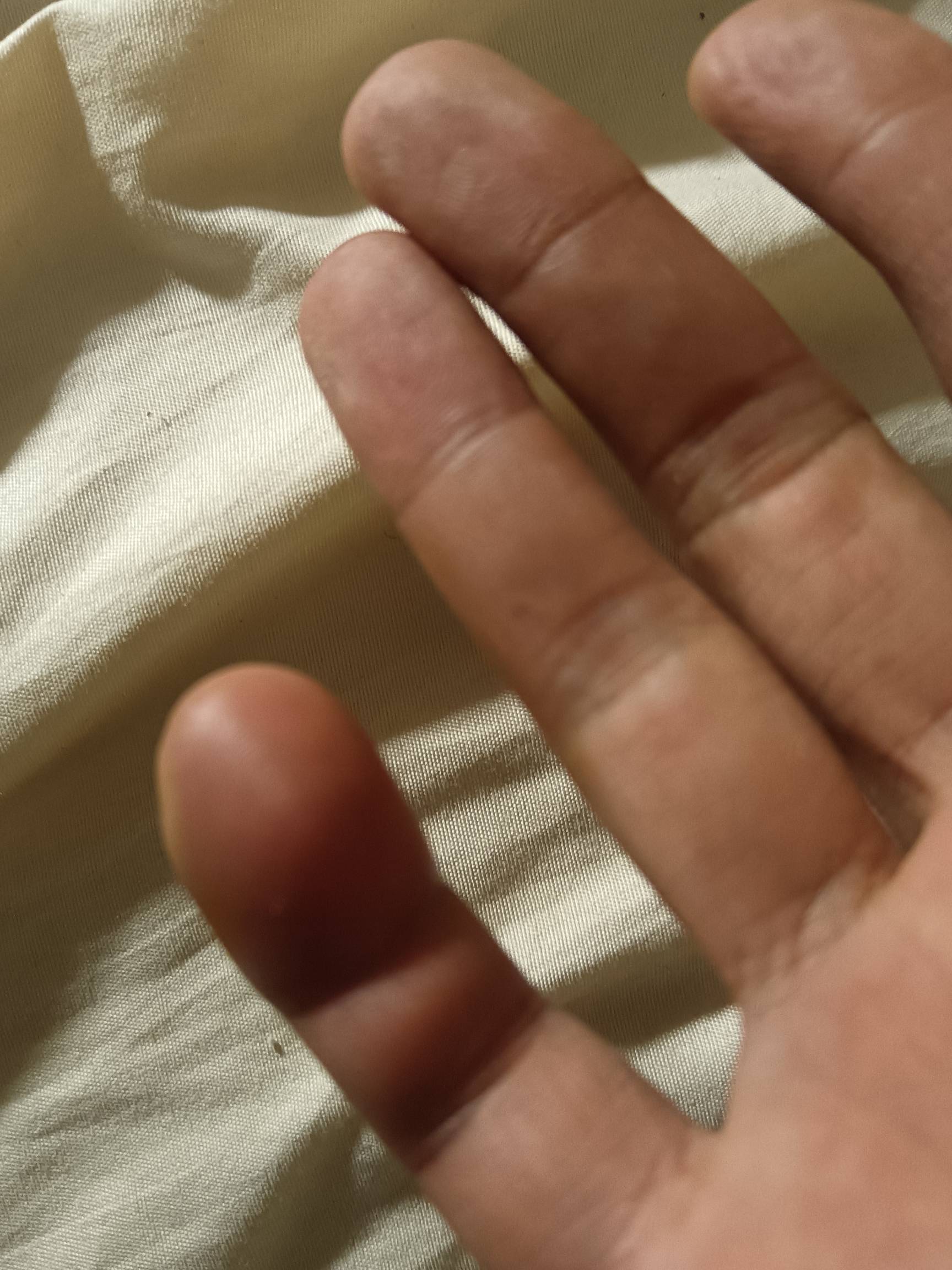 玛德肿成这样子了


21 / 作者:蛋黄酱 / 