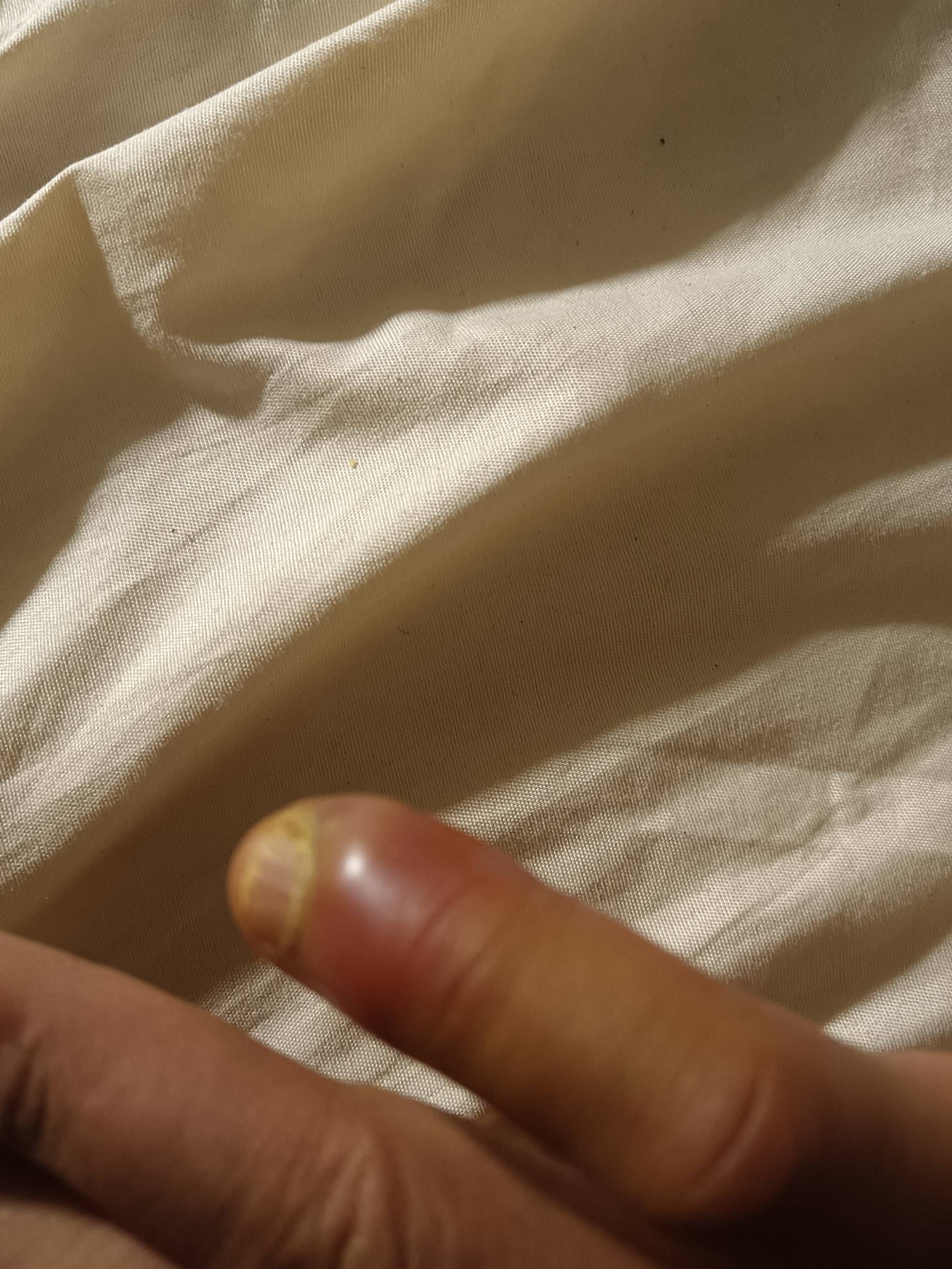 玛德肿成这样子了


75 / 作者:蛋黄酱 / 