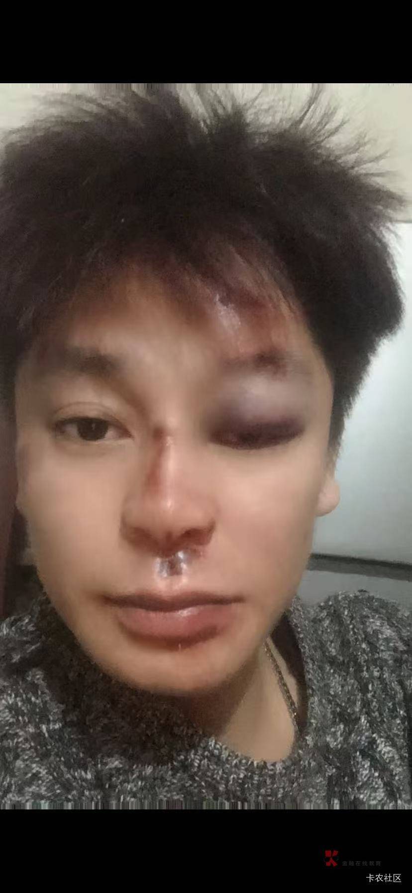 盼之拿了50万，美滋滋 能过个好年，

99 / 作者:孤独的泾县人 / 