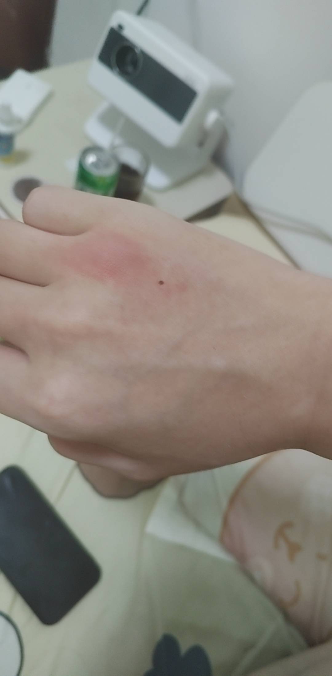 干他孃，被咬醒了，怎么7点点个蚊香这么快就没了，这样算，我一天岂不是要点两个蚊香46 / 作者:挂比了救我鸭 / 