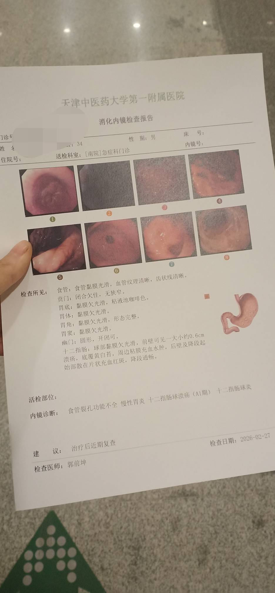 老哥们千万别再喝冰镇啤酒或者冰镇饮料什么的了，身体最重要。

81 / 作者:钵钵鸡666 / 