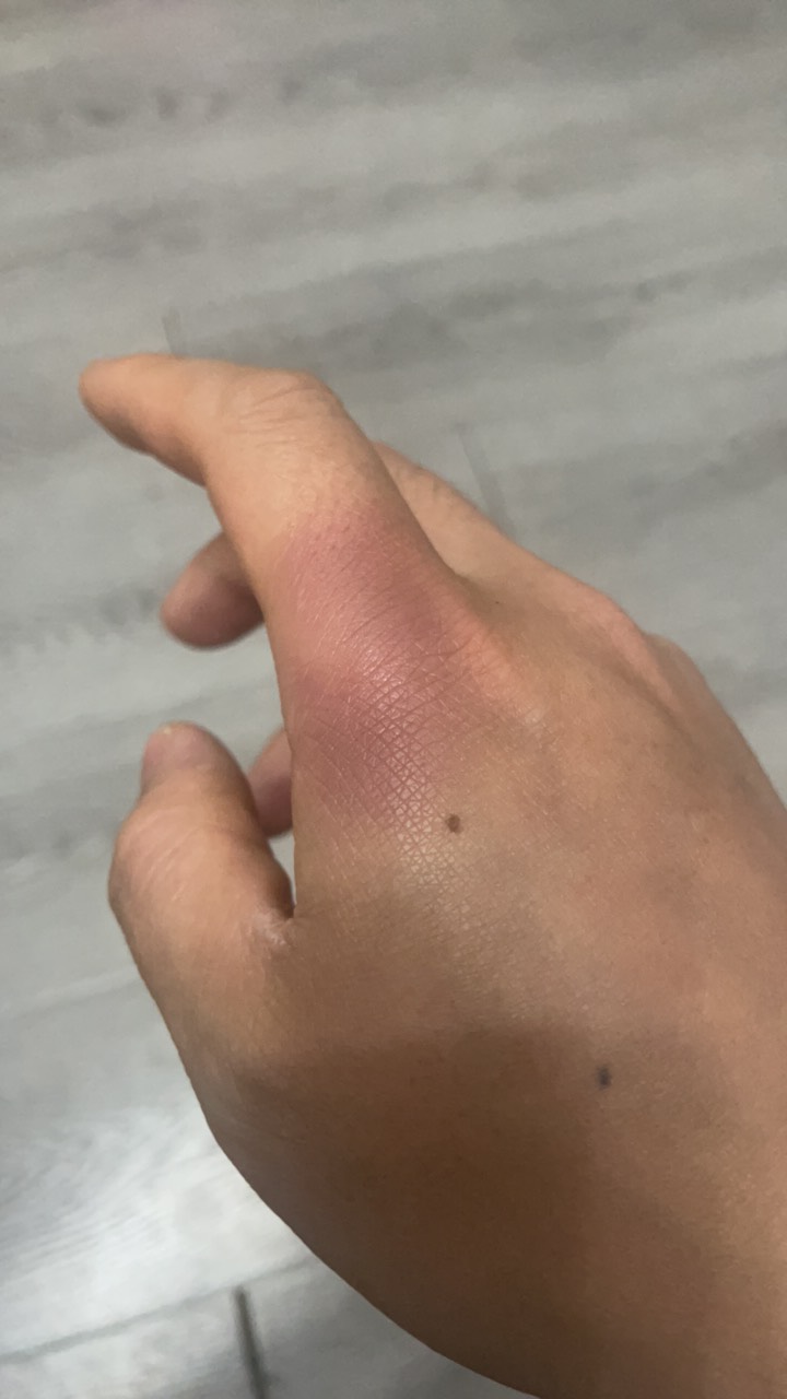 今天下午送外卖摔得左边腿动不了。自己坐在路边坐了一个多小时，感觉生活…………一无48 / 作者:卡农第一富哥 / 