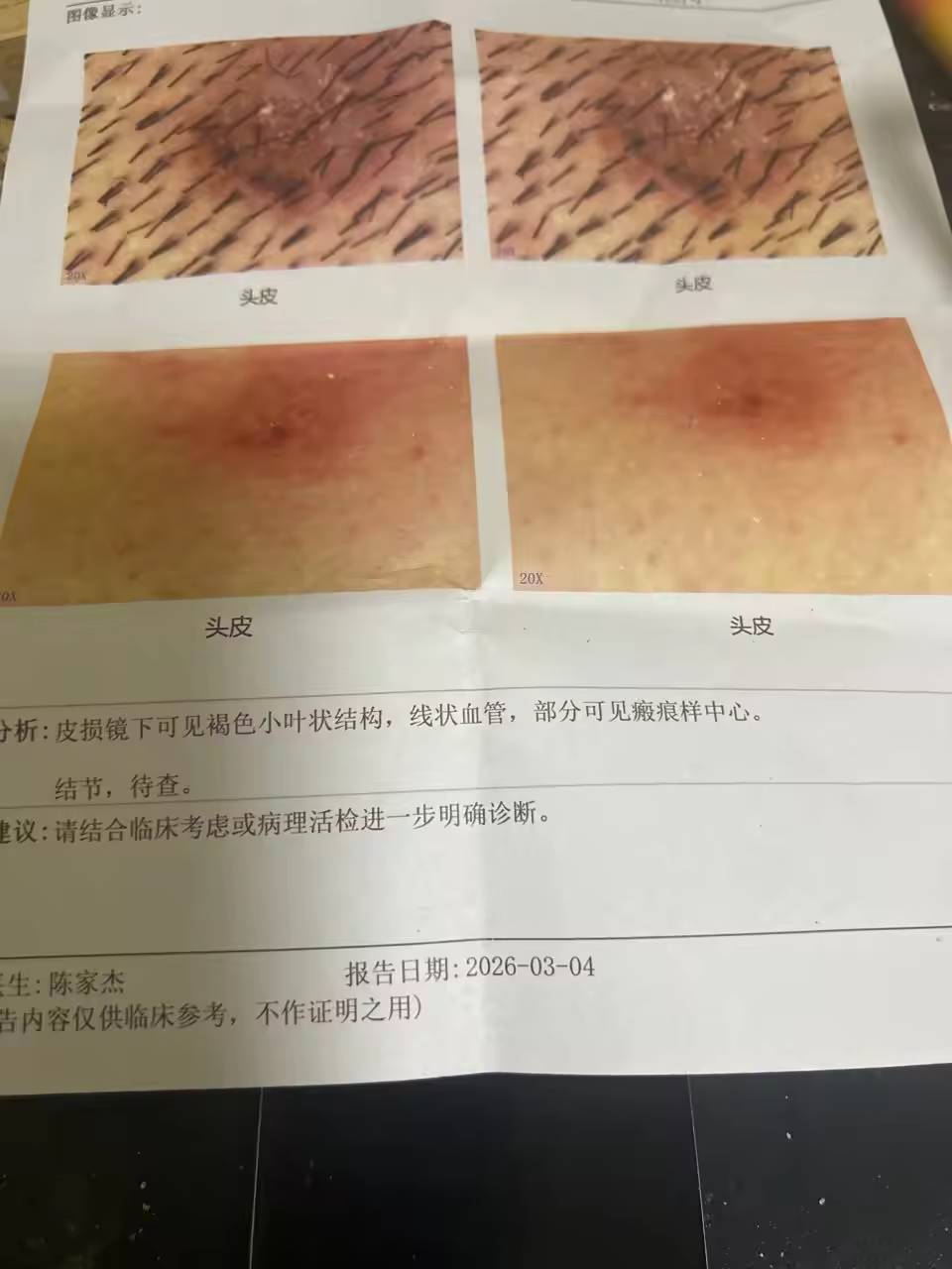 熬夜熬的草


28 / 作者:turbo小宇宙 / 