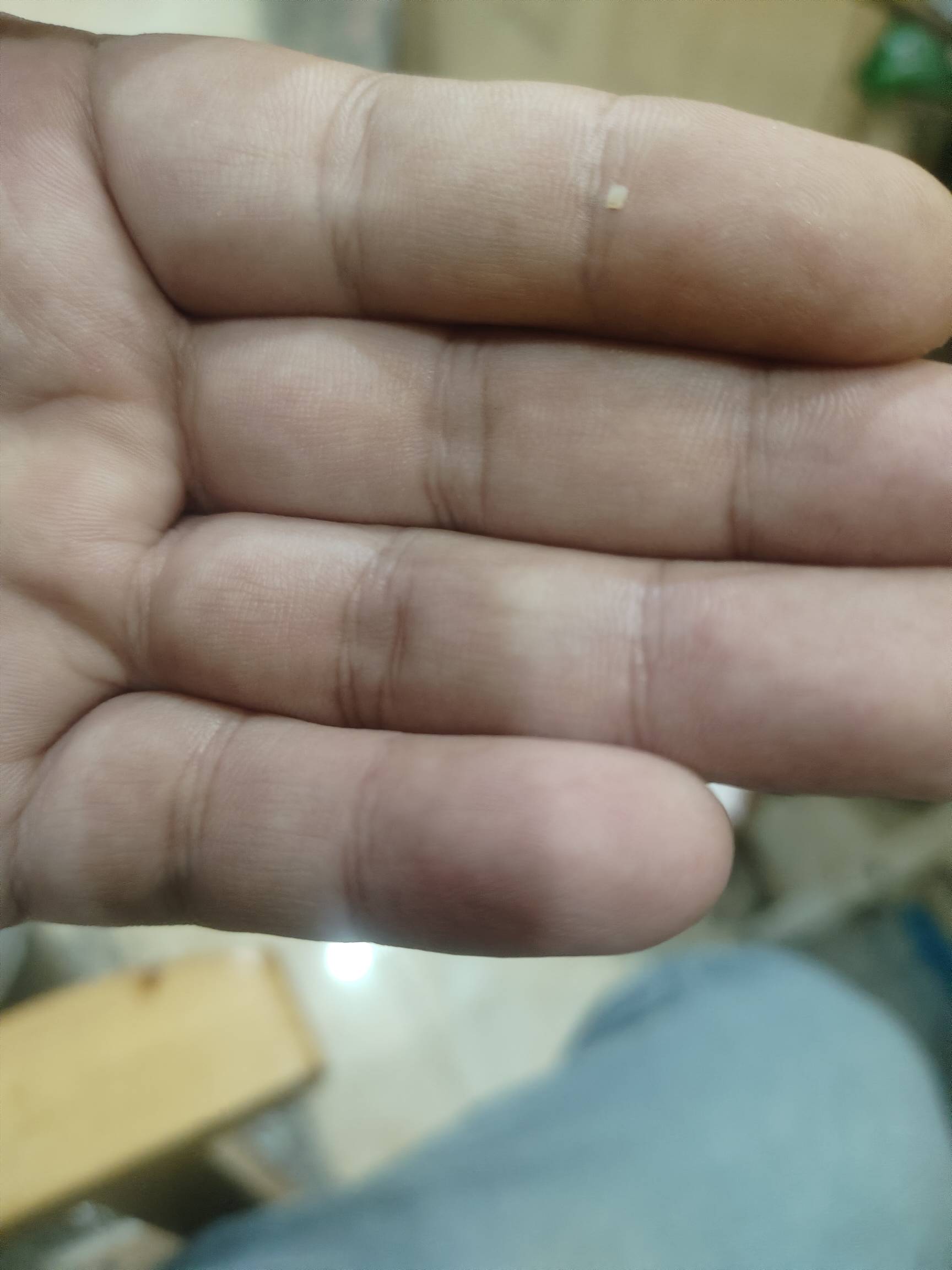 过年吃白切鸡太硬了把下排右边里面倒数第二颗磨牙上面崩出了一个缺口，导致吃东西一直10 / 作者:要辩难辩 / 