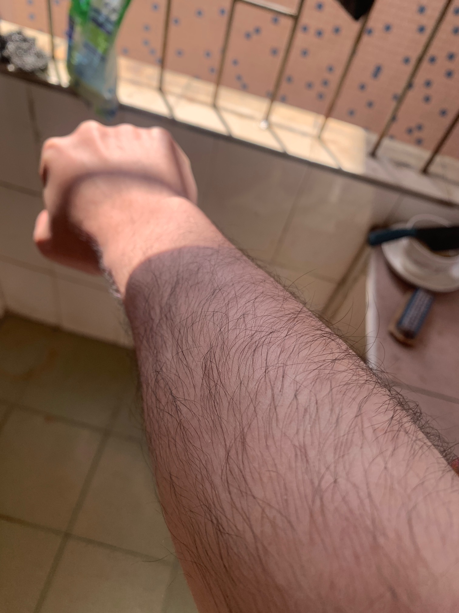 老哥们，手毛好多怎么办

8 / 作者:落叶随风i / 