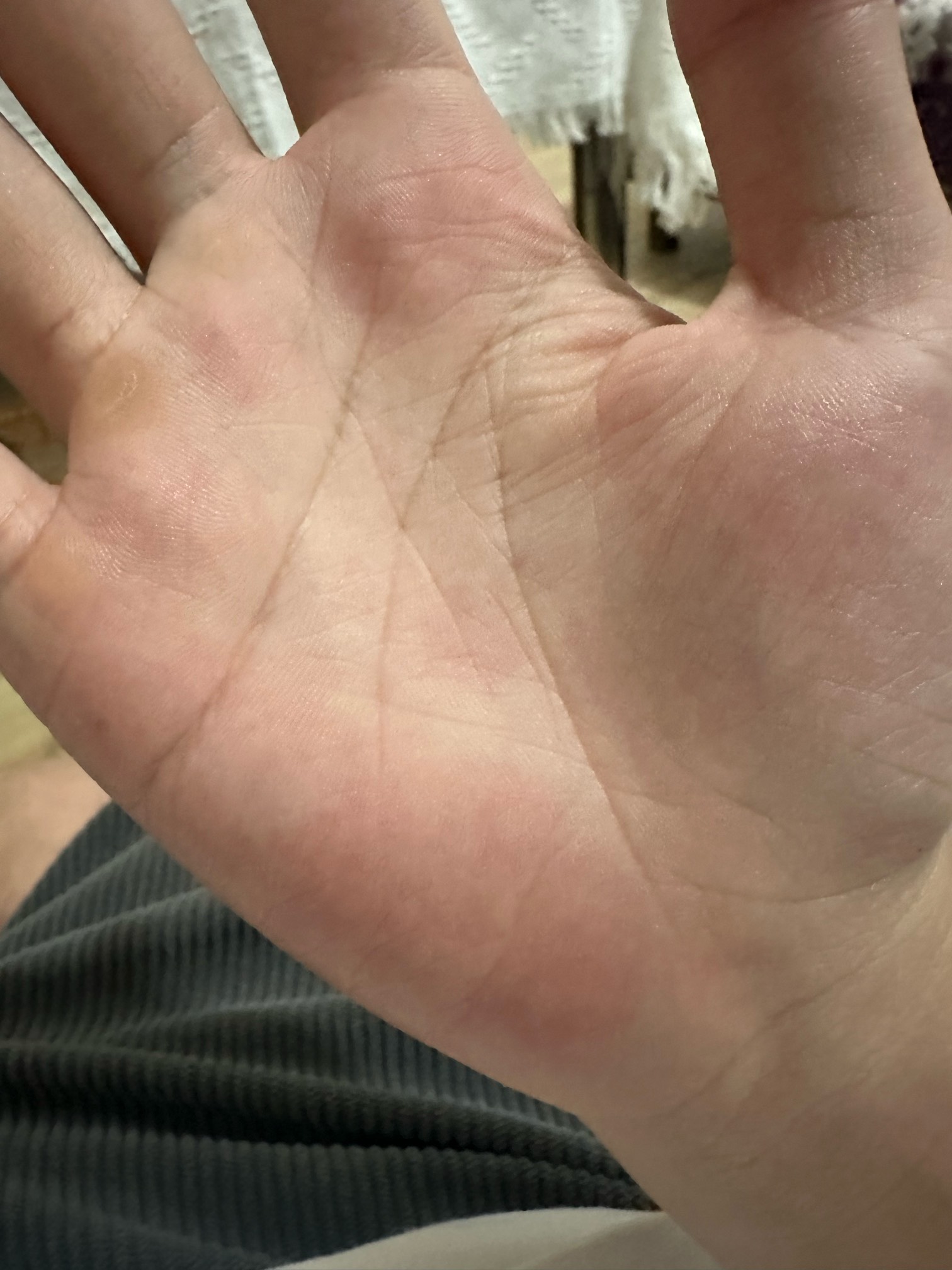 有没有老哥会看手相，我这是不是辛苦命

53 / 作者:小熊咔咔咔 / 