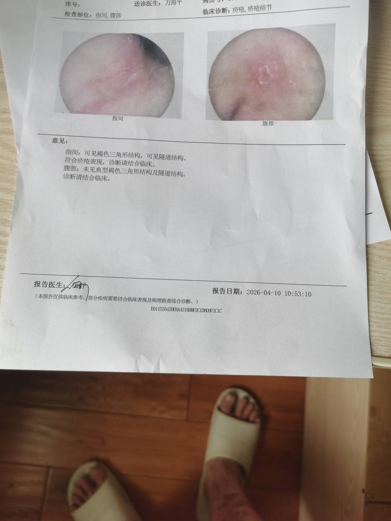 老哥们去医院看医生了，得了疥疮。

94 / 作者:爱酷123 / 