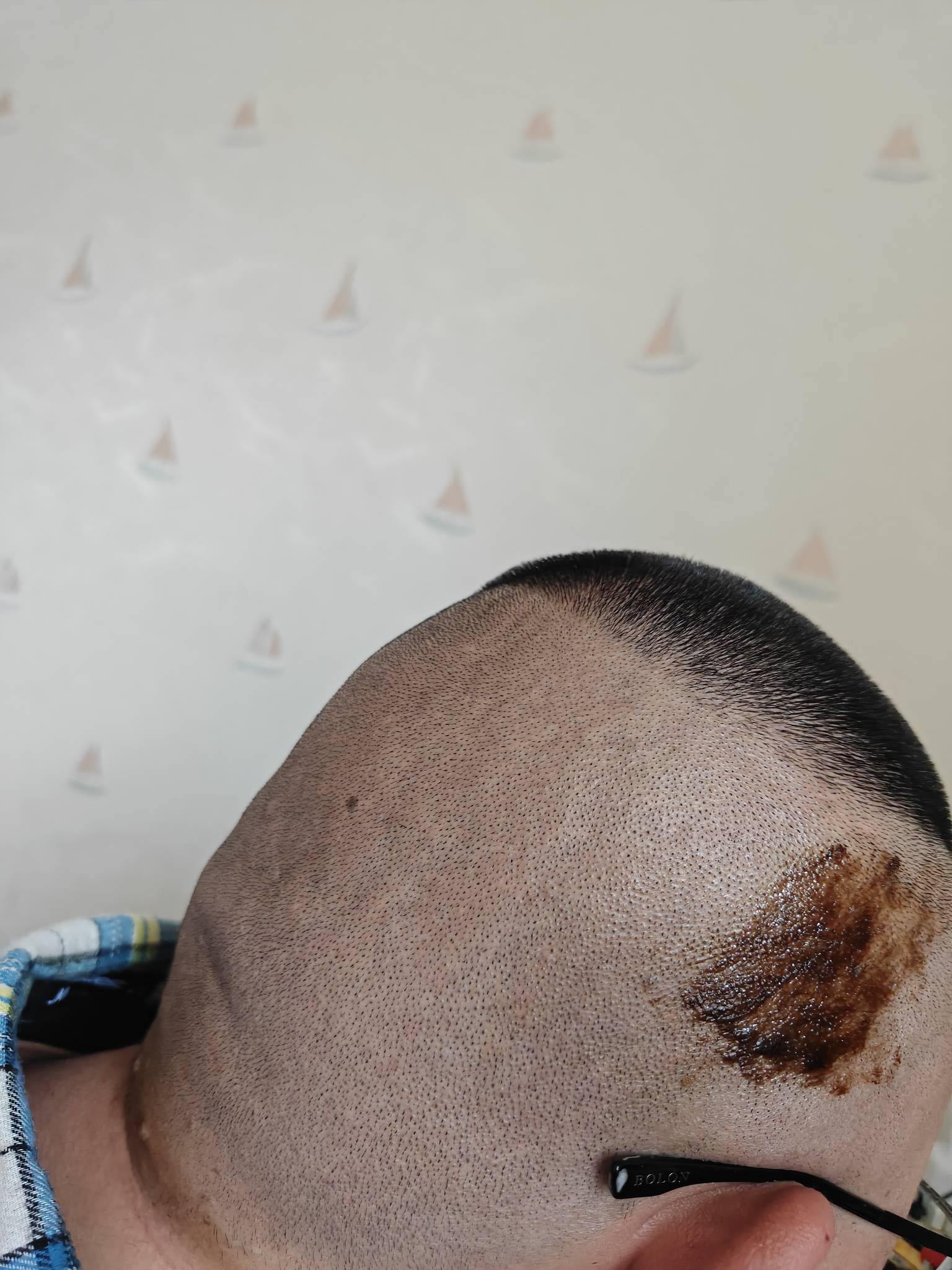 黑玉断续膏

51 / 作者:turbo小宇宙 / 