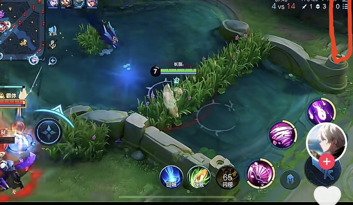 没搞懂怎么玩助攻啊。有没有老哥具体流程教一下？
12 / 作者:瘫痪两年半 / 