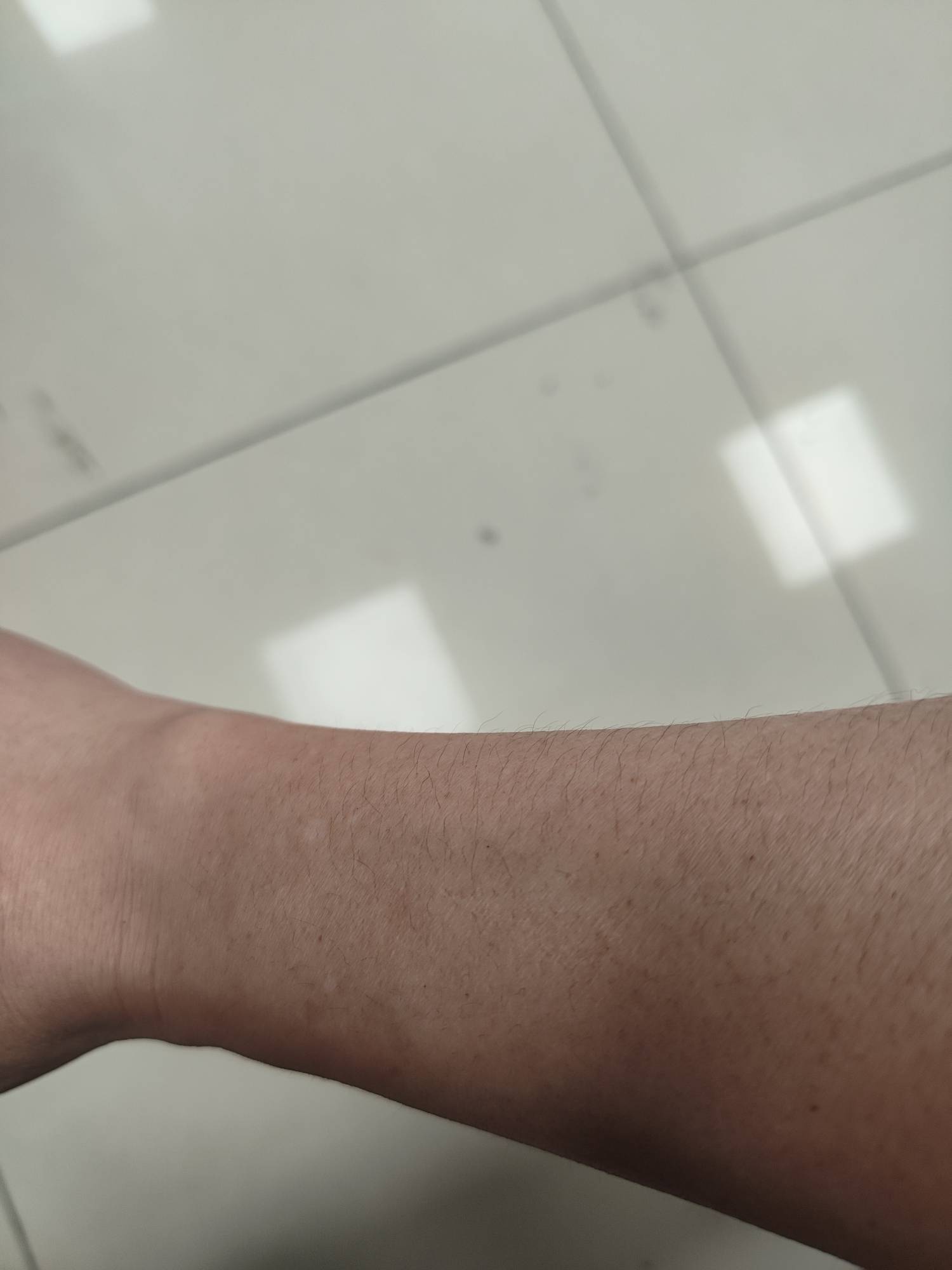 老哥们我手腕细的跟竹竿一样，有什么办法能让他变粗，夏天都不好意思穿短袖

84 / 作者:几把毛都没有绝望了 / 