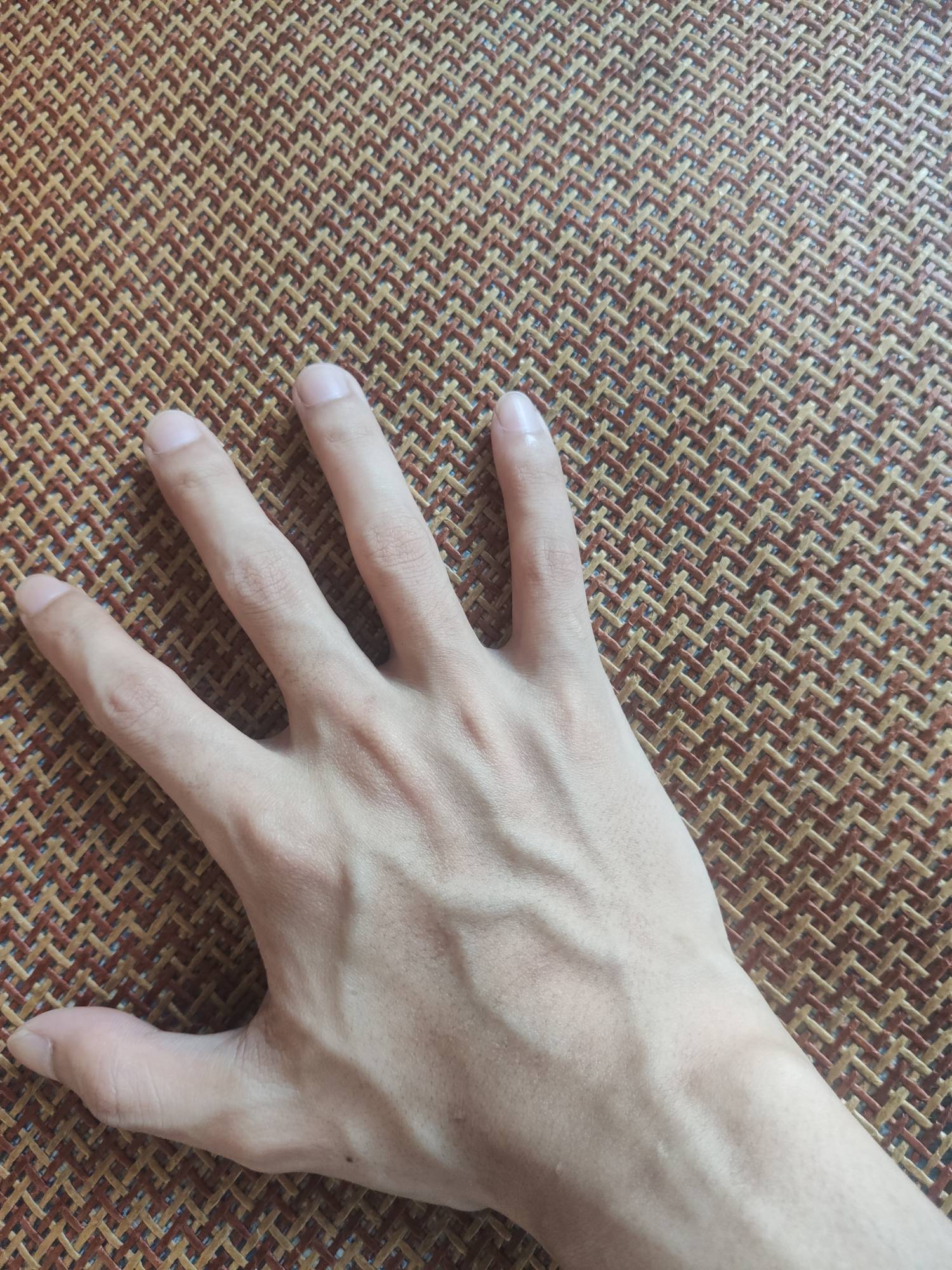 有的人越躺越胖，而我越躺越瘦，基因不同吗，100斤


100 / 作者:王轩续集 / 