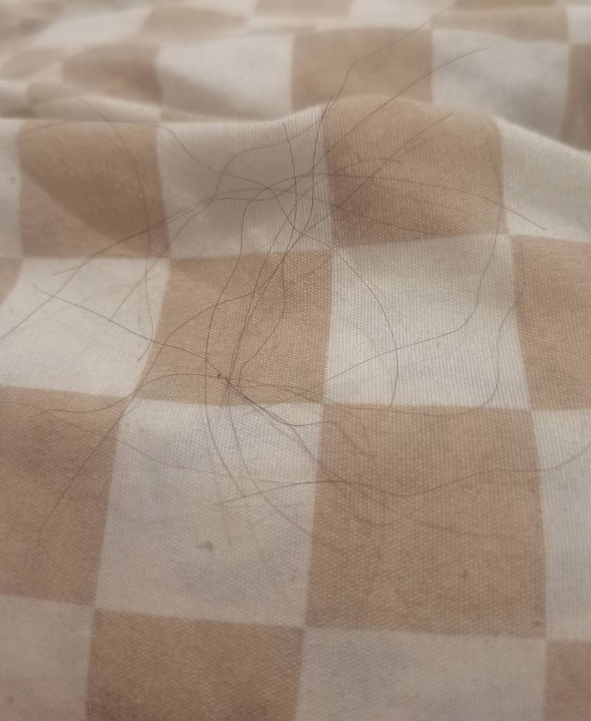 这头发怎么掉的，难受真秃了

12 / 作者:第七章 / 