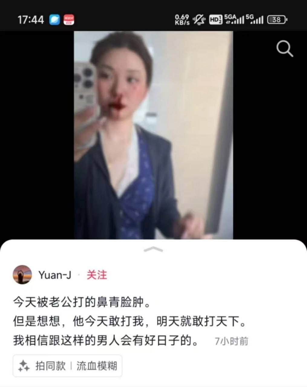 饿晕了赶紧发毛啵啵们

0 / 作者:lfc8 / 