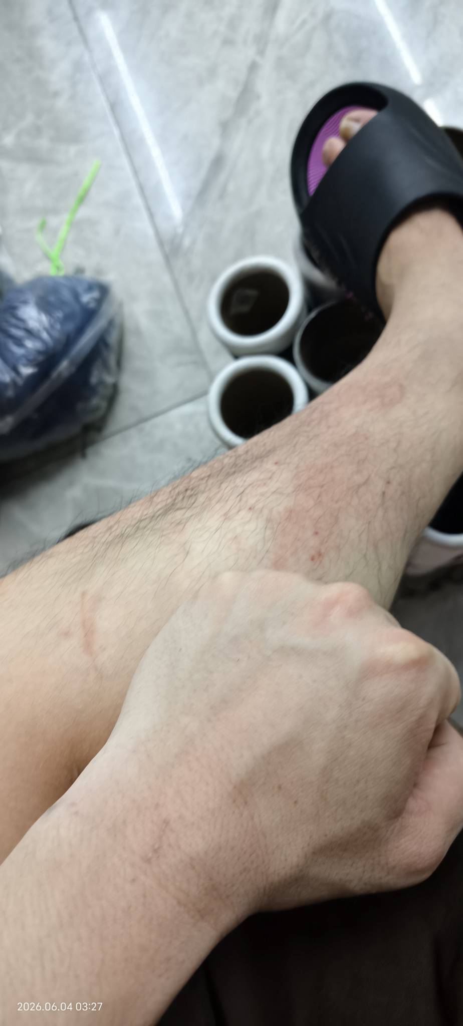 特么的，这个厂有毒。好痒，一天12小时。一人看30台机器，忙的奥特曼都要闪红灯。


16 / 作者:逼两拳皇 / 