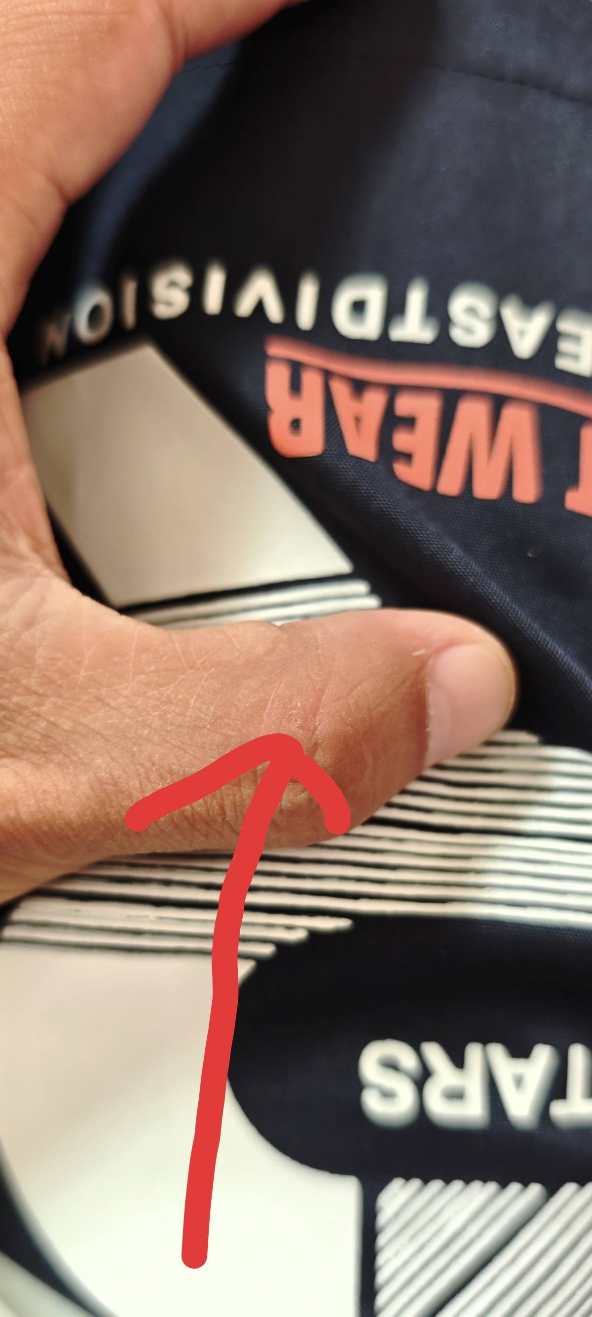 老哥们，家养的三个月大小狗牙齿碰伤了一丁点皮，渗了一点点血，需要打疫苗不

97 / 作者:有态度 / 