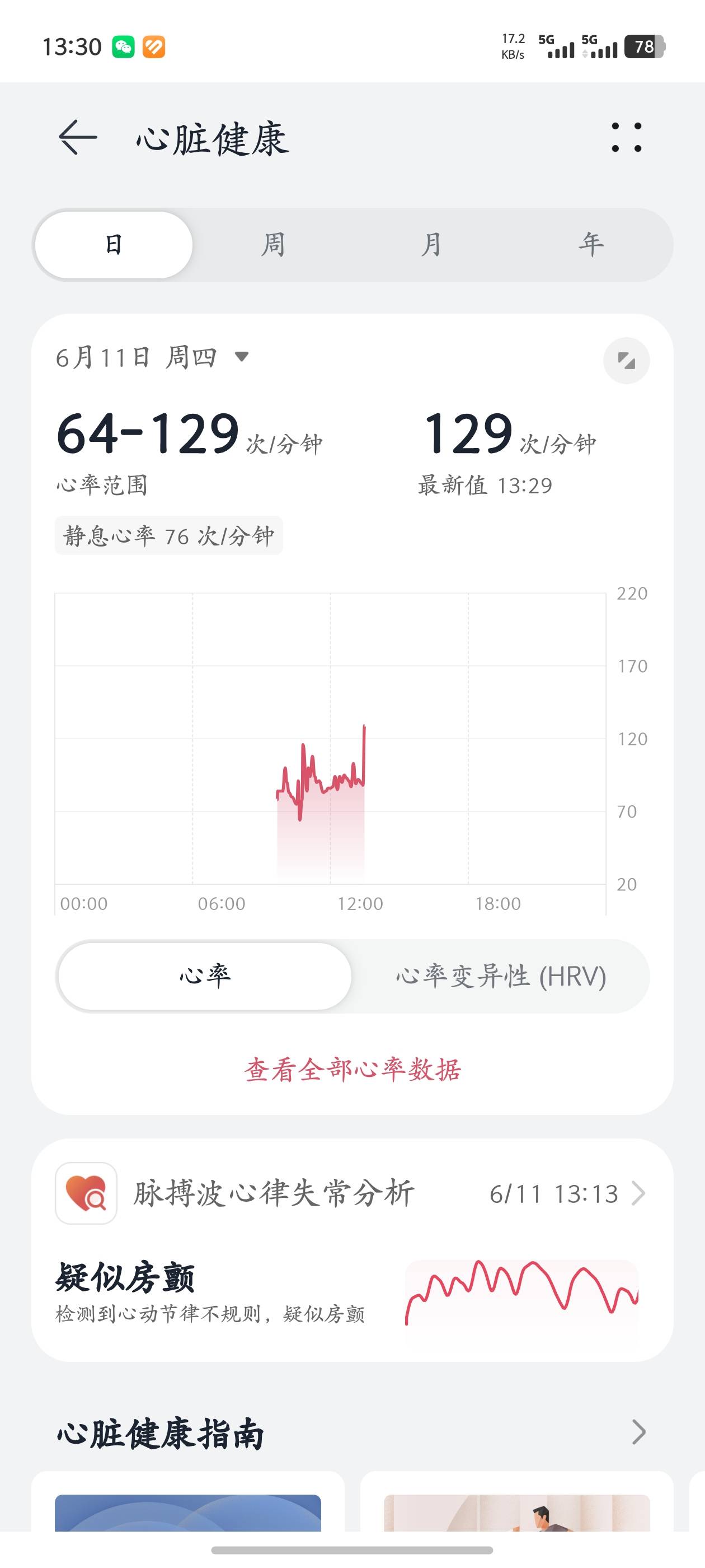 感觉命不久矣


56 / 作者:我不是挂壁仔 / 