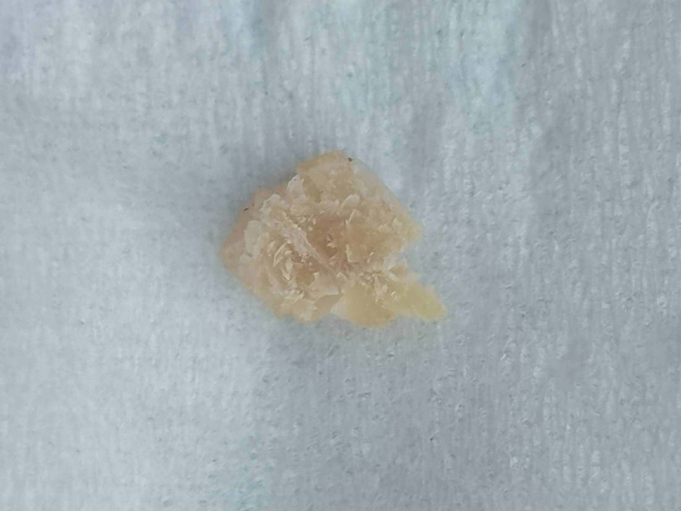 左边腹部有点痛怎么回事，昨天下午被尿憋醒了就是这样，按压也有点痛
31 / 作者:懂哥 / 