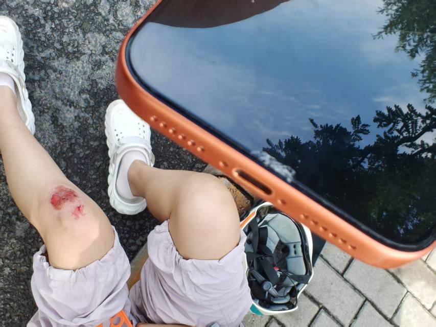 接上贴，去交警队看了那条路上没监控，跑的那个电动车抓不到，本打算赔她点医药费得了12 / 作者:卡农咚咚 / 