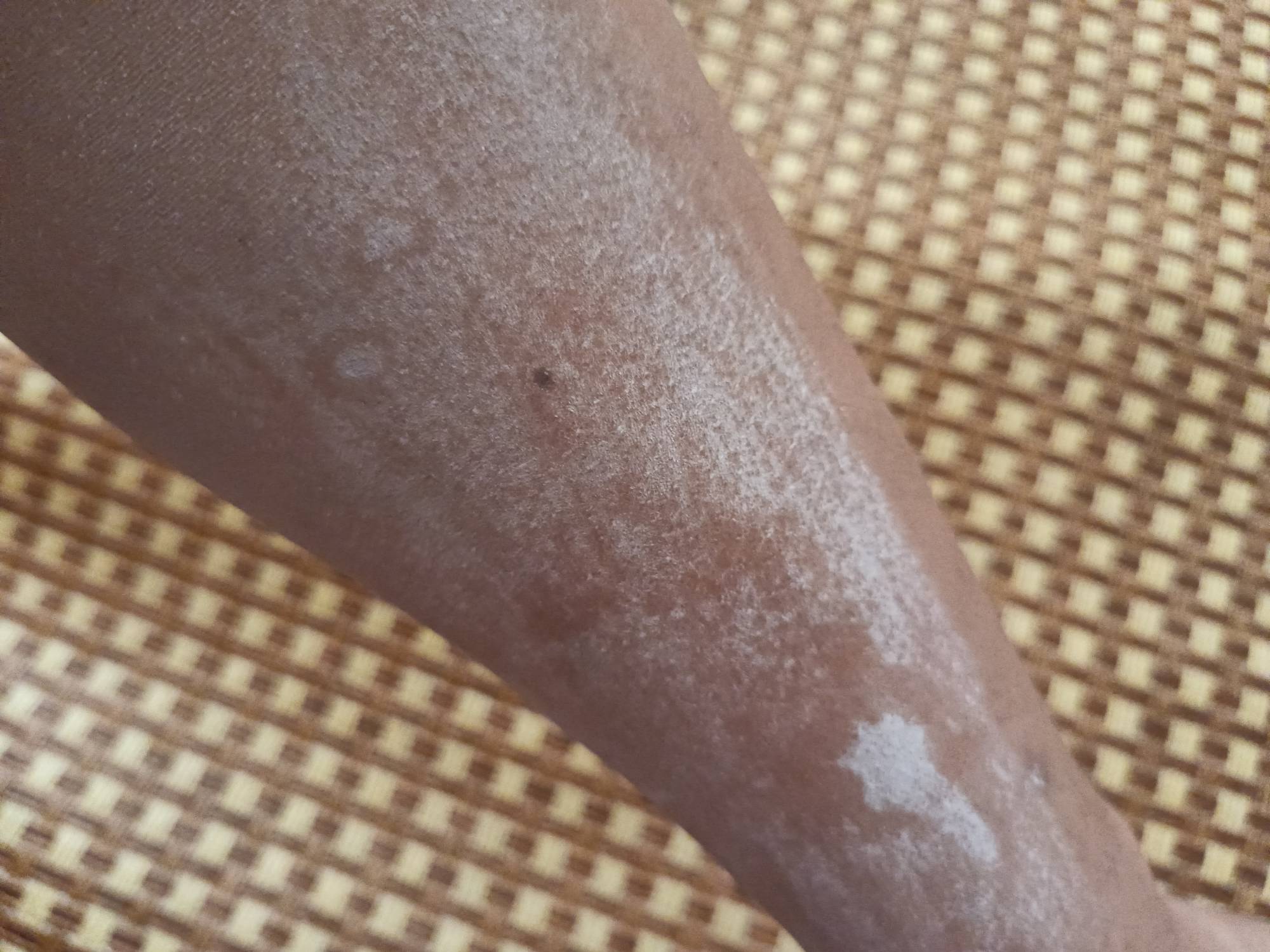 昨天的日结工资到了，挣点钱不容易啊，太热痱子都冒出来了，今天抹了药好多了。



63 / 作者:生蚝熟了 / 