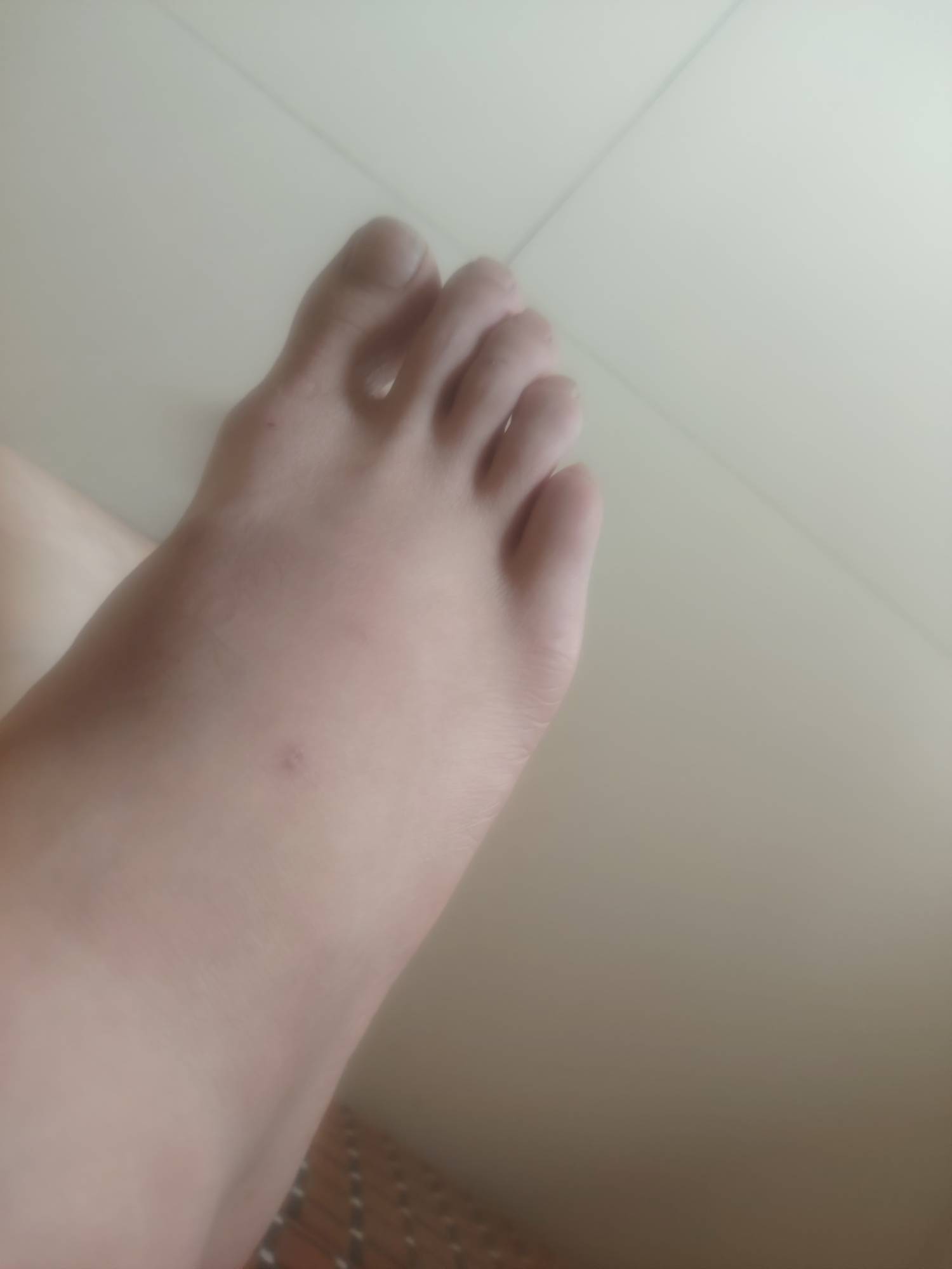 真倒霉啊，昨晚下班骑电动车，因为前面人多那里很多老头老太骑电动车三轮车想转弯就直52 / 作者:七吖 / 