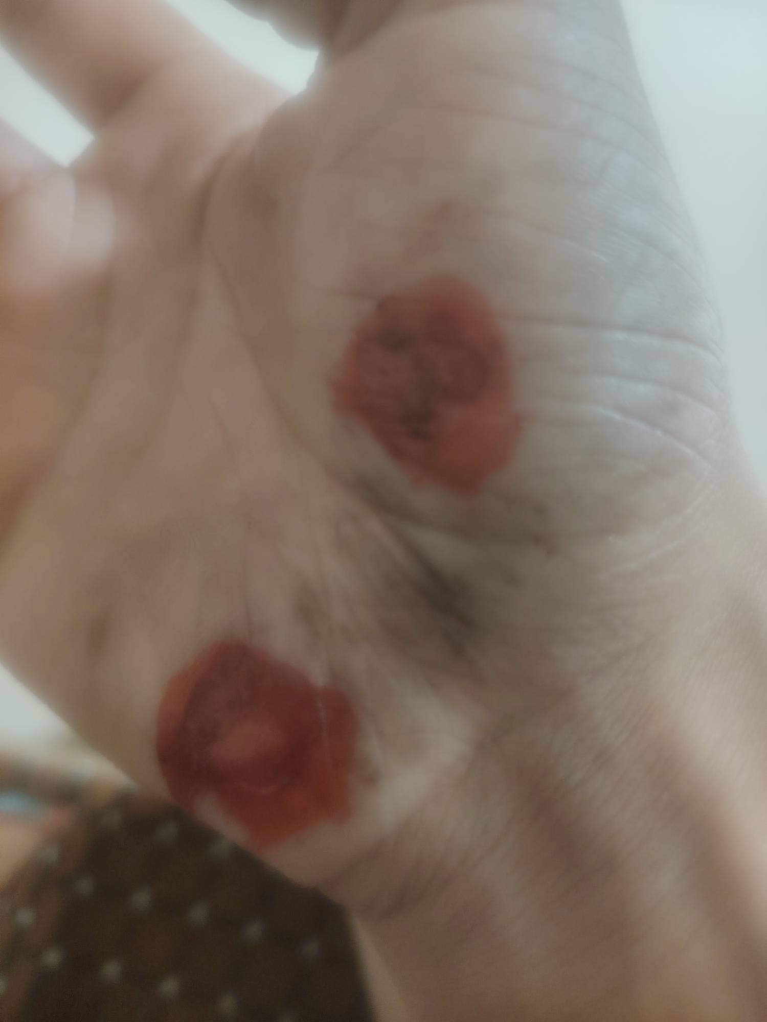 真倒霉啊，昨晚下班骑电动车，因为前面人多那里很多老头老太骑电动车三轮车想转弯就直67 / 作者:七吖 / 