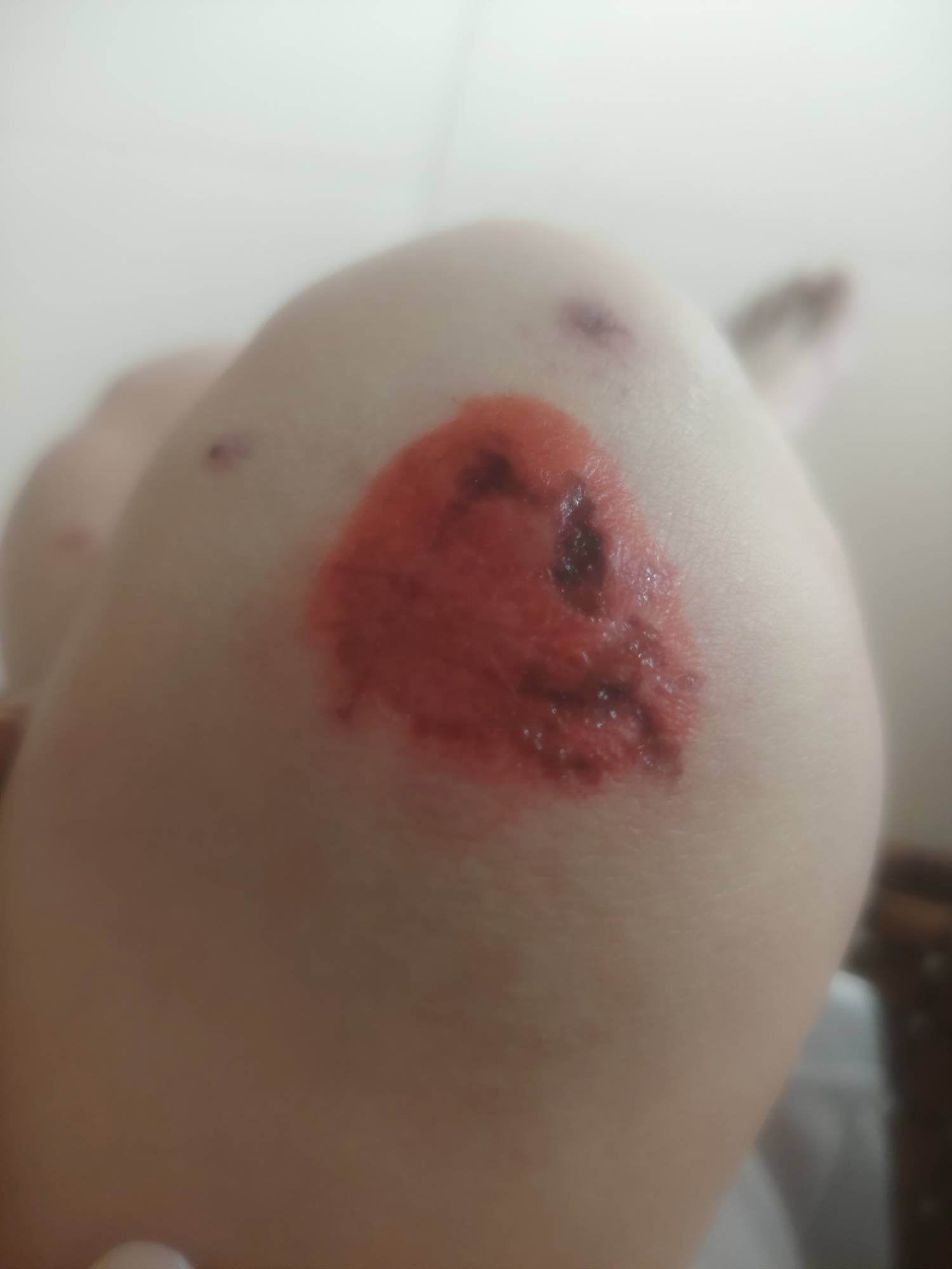 真倒霉啊，昨晚下班骑电动车，因为前面人多那里很多老头老太骑电动车三轮车想转弯就直4 / 作者:七吖 / 