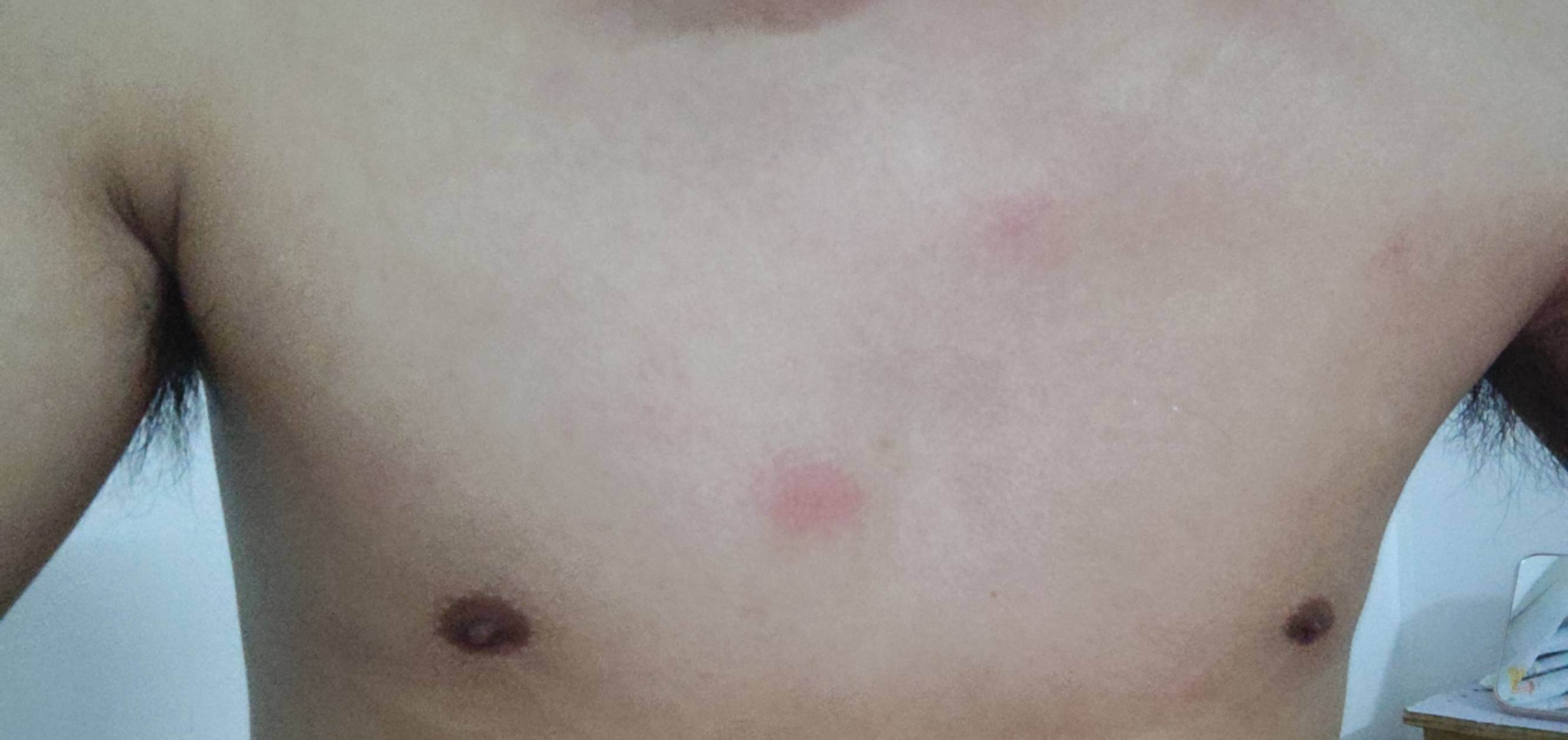 我的大广东啊你到底想干嘛想热死我们吗身上都热出红点点了。36℃感觉在桑拿房差不多

48 / 作者:晴空免疫性 / 